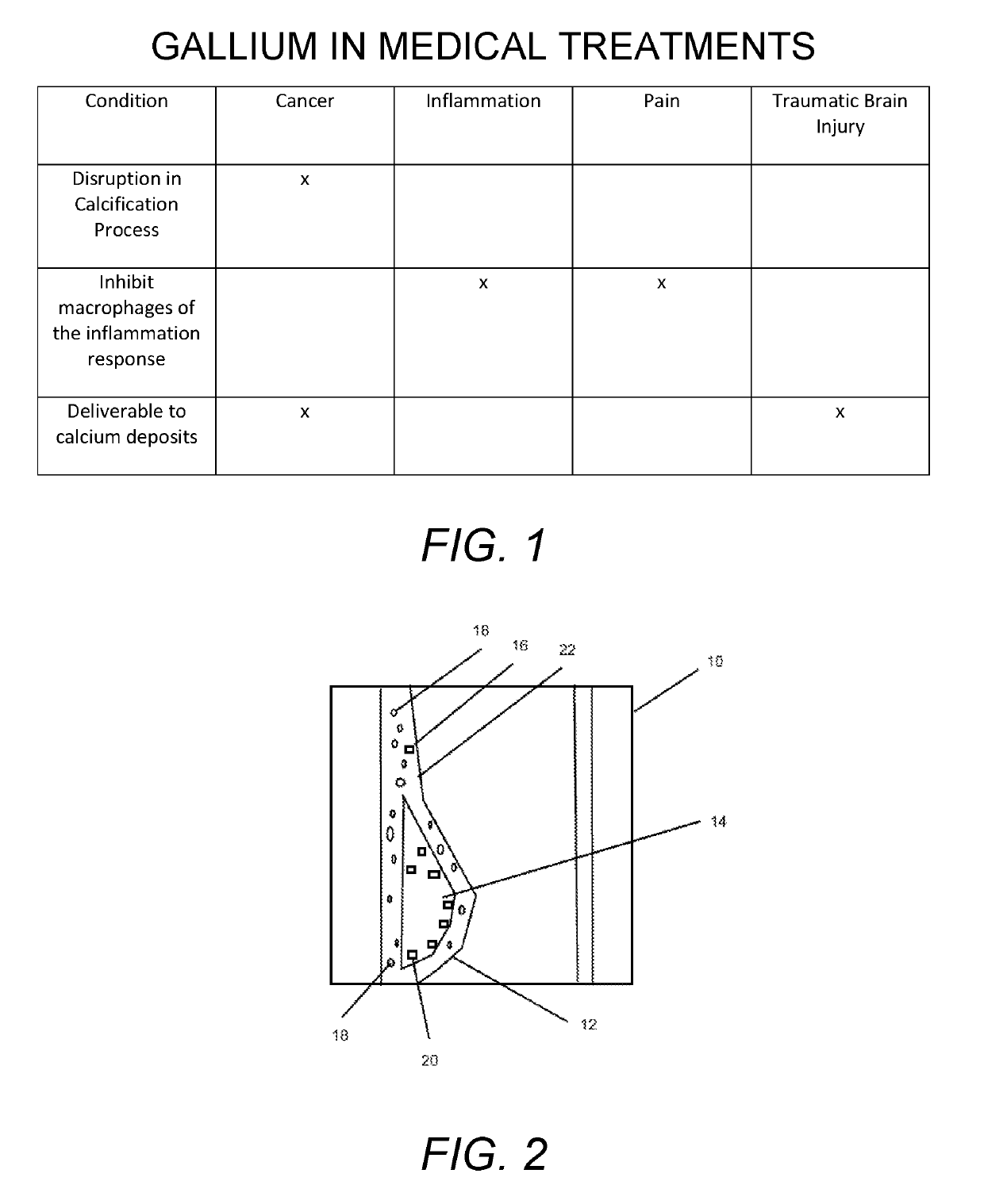 Treatment of cardiovascular disease by using gallium compounds to bind calcified lesions