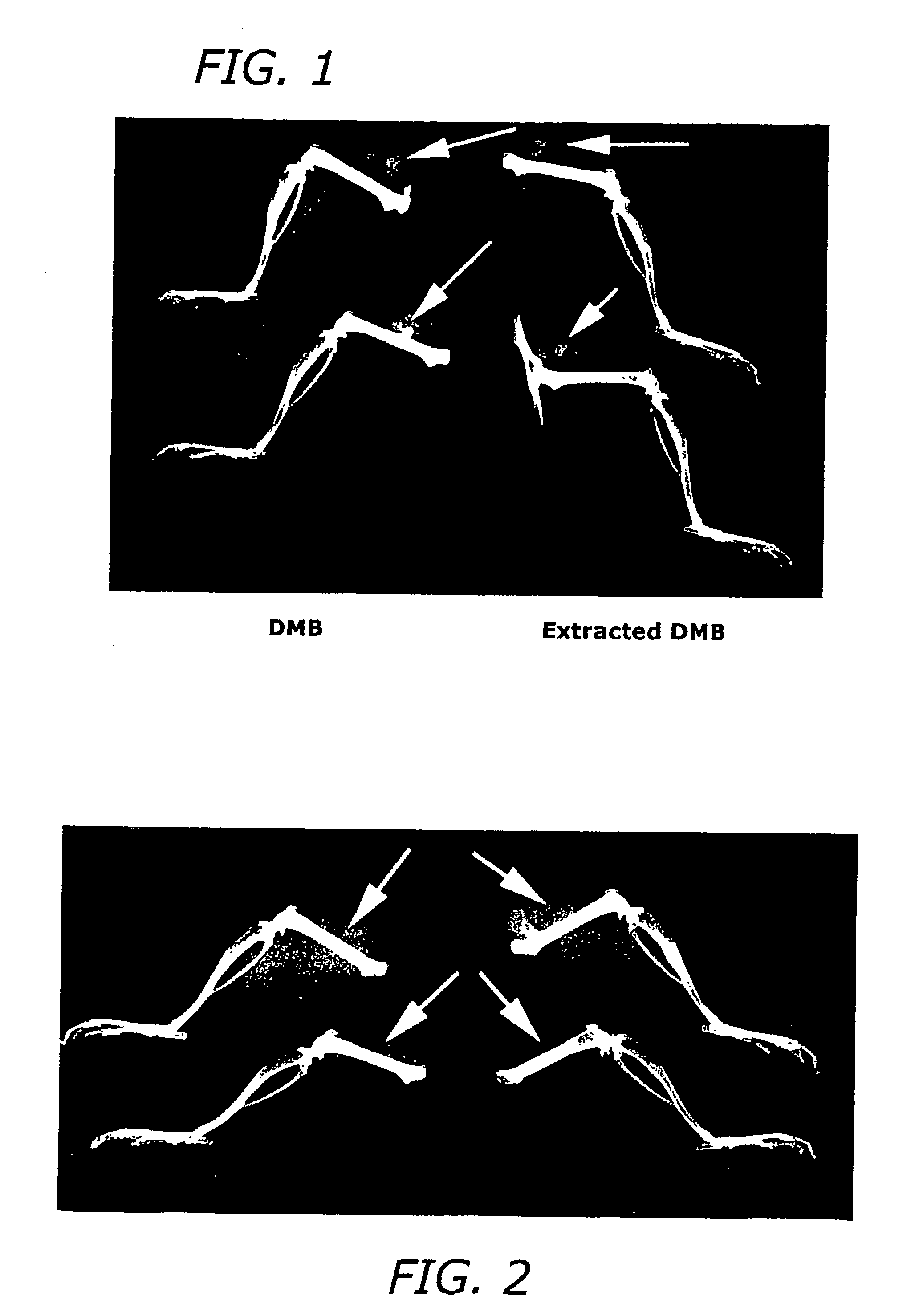 Activating Extraction Of Demineralized Bone Matrix