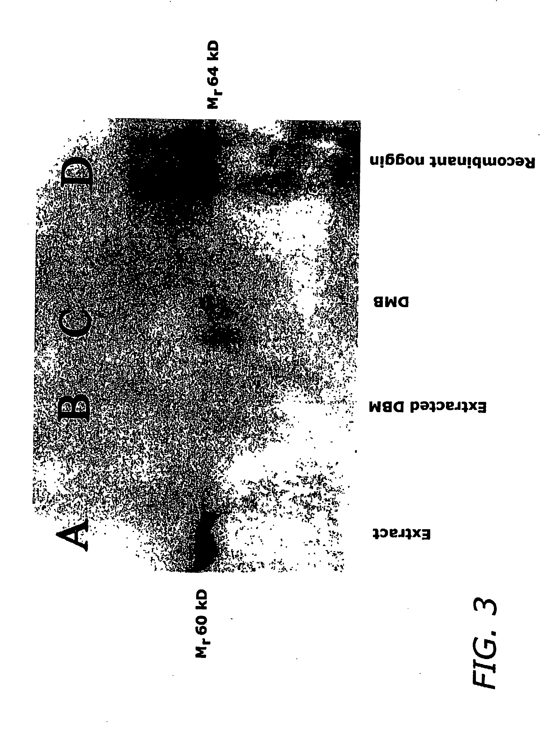 Activating Extraction Of Demineralized Bone Matrix