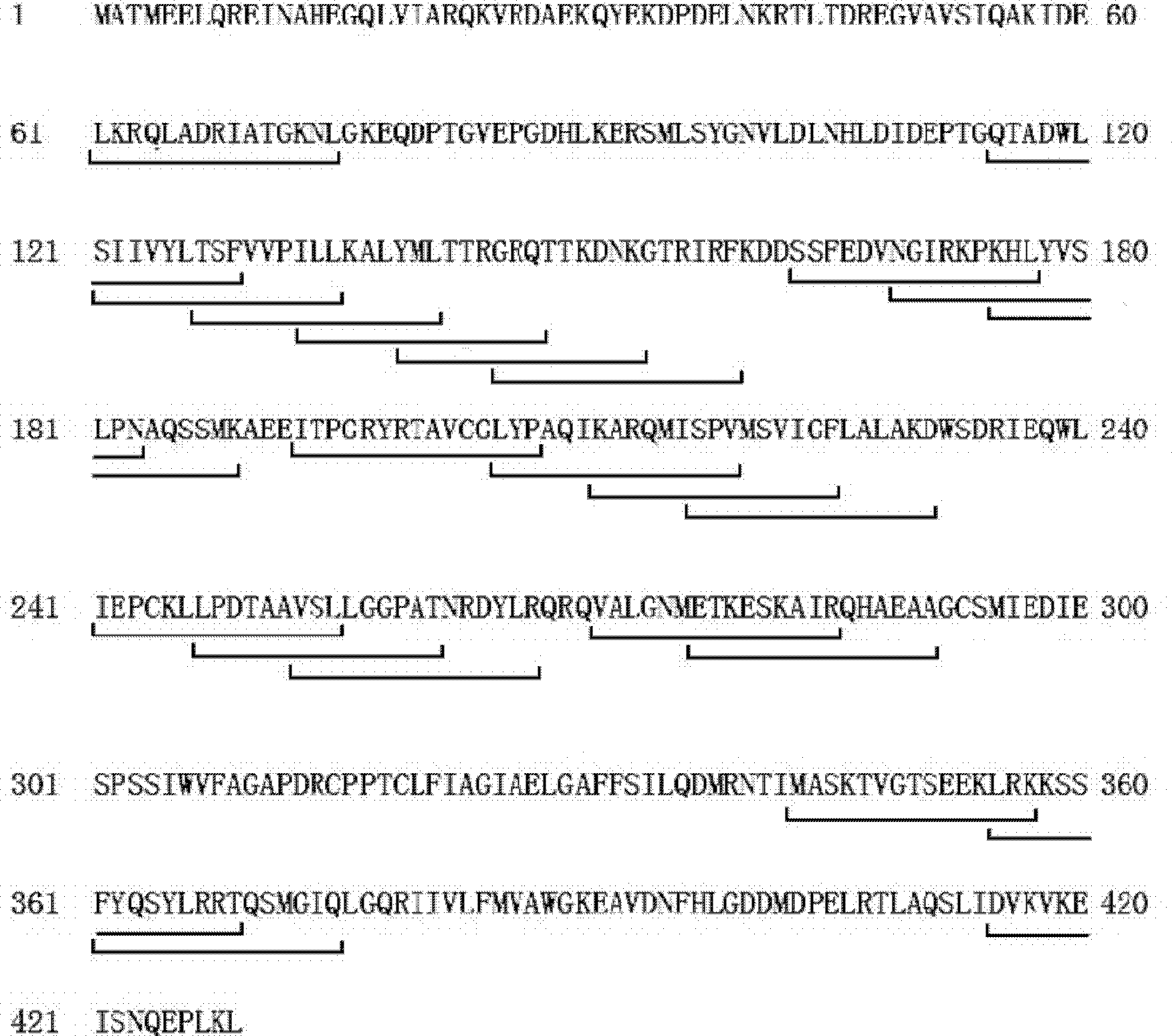 HTNV-NP (Hantaan virus nucleoprotein)-specific CTL (cytotoxic T lymphocyte) epitope peptides and application thereof