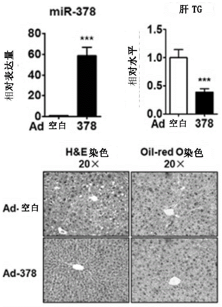 Application of miRNA-378 in treatment of fatty liver