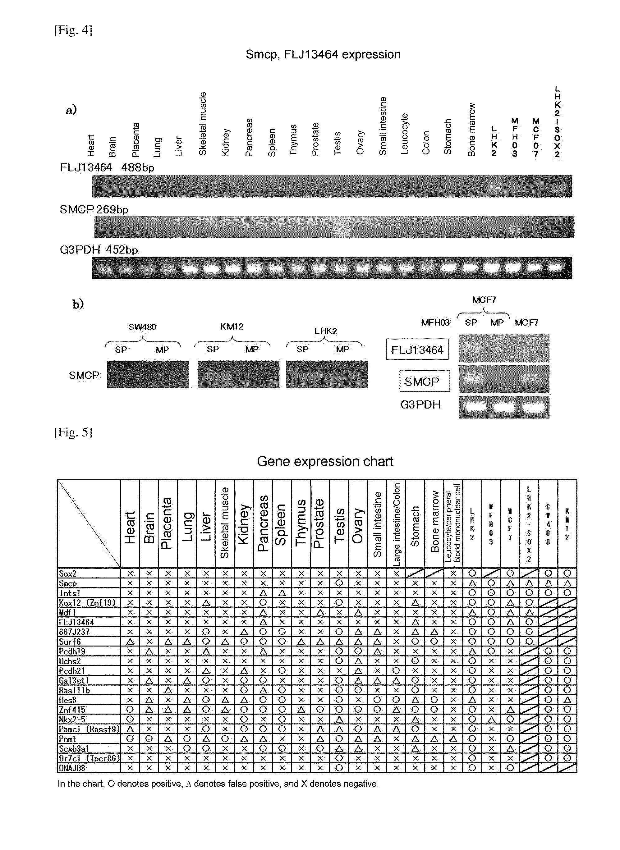 Molecular marker for cancer stem cell