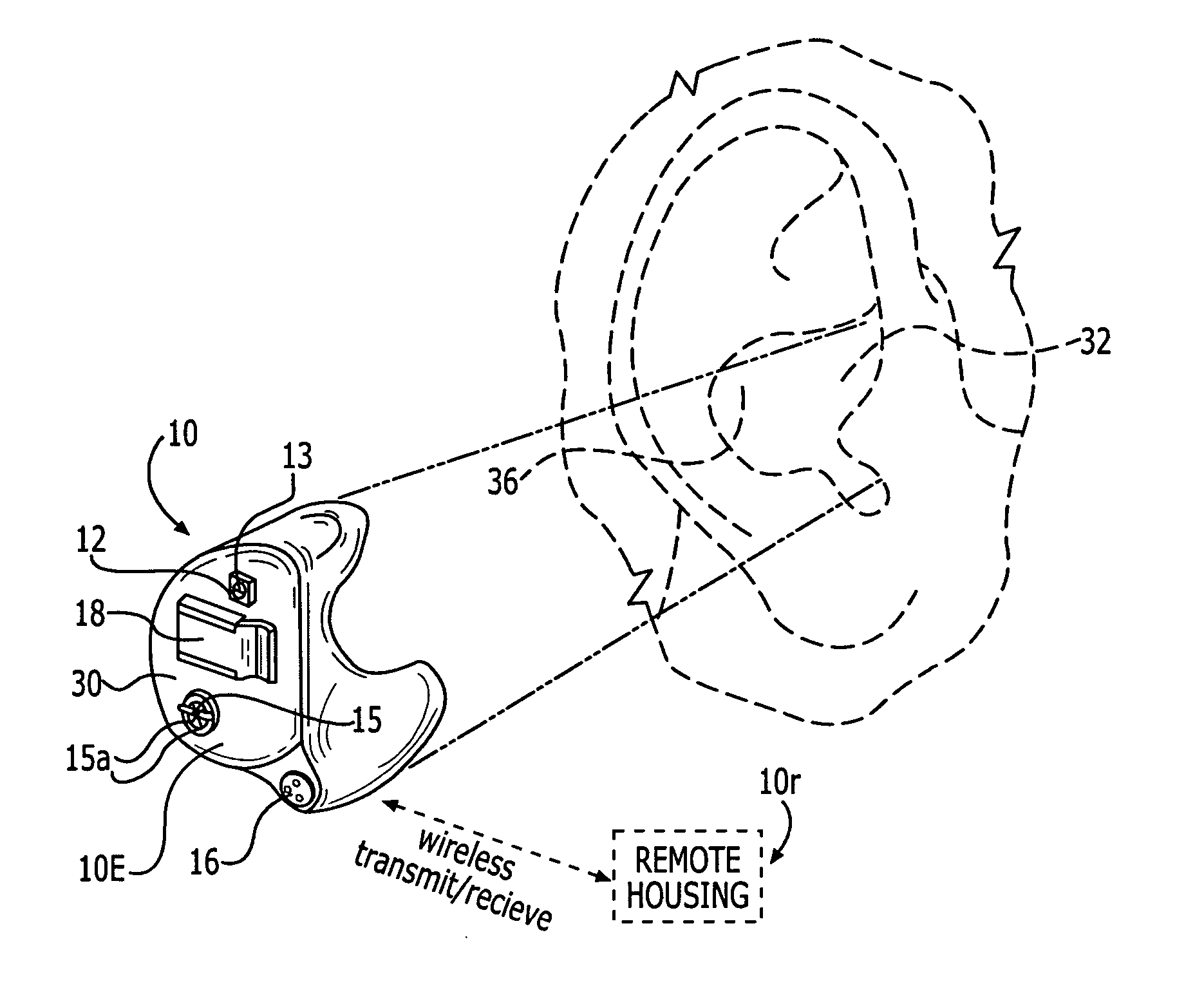 Methods and devices for treating non-stuttering speech-language disorders using delayed auditory feedback