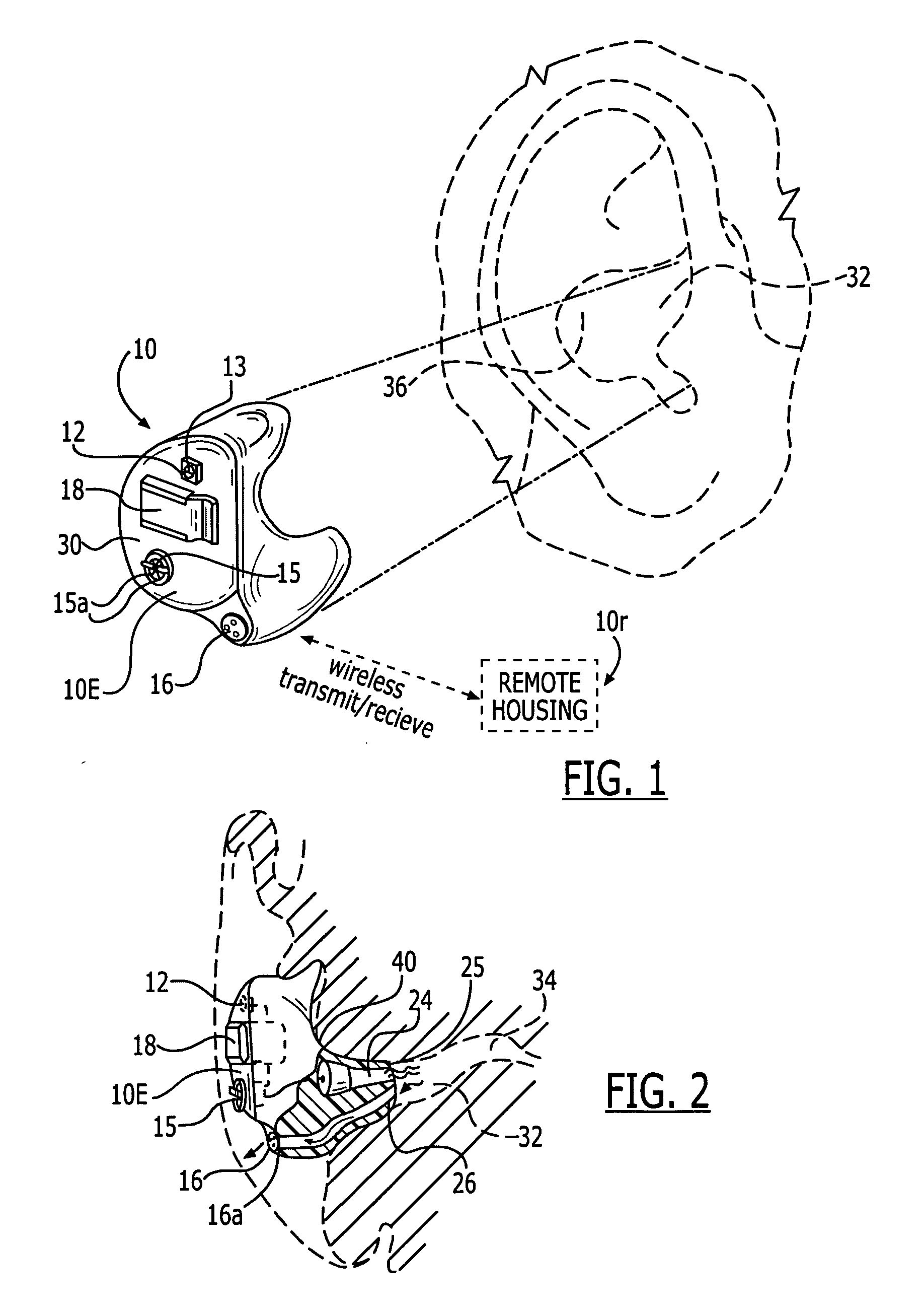 Methods and devices for treating non-stuttering speech-language disorders using delayed auditory feedback