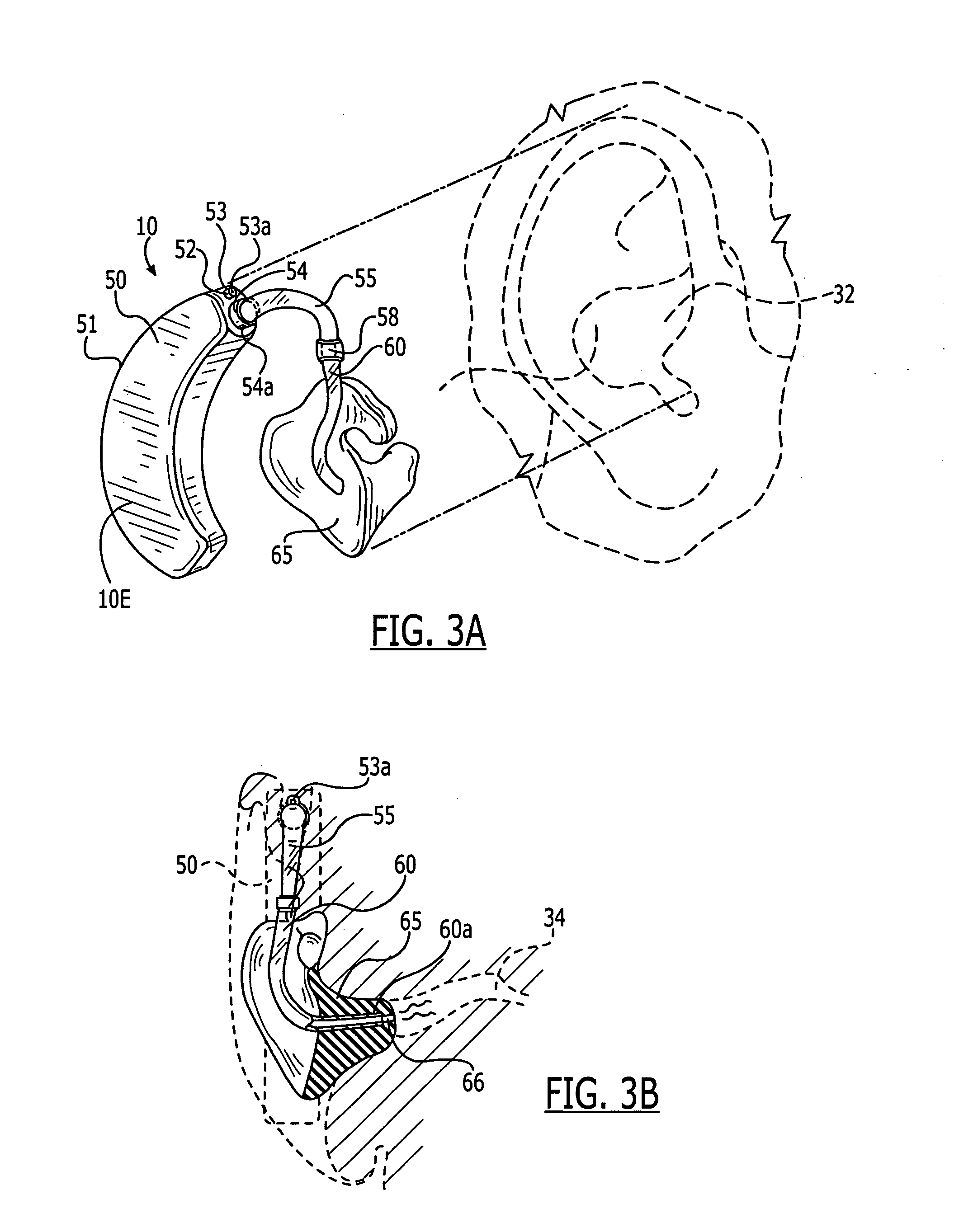 Methods and devices for treating non-stuttering speech-language disorders using delayed auditory feedback