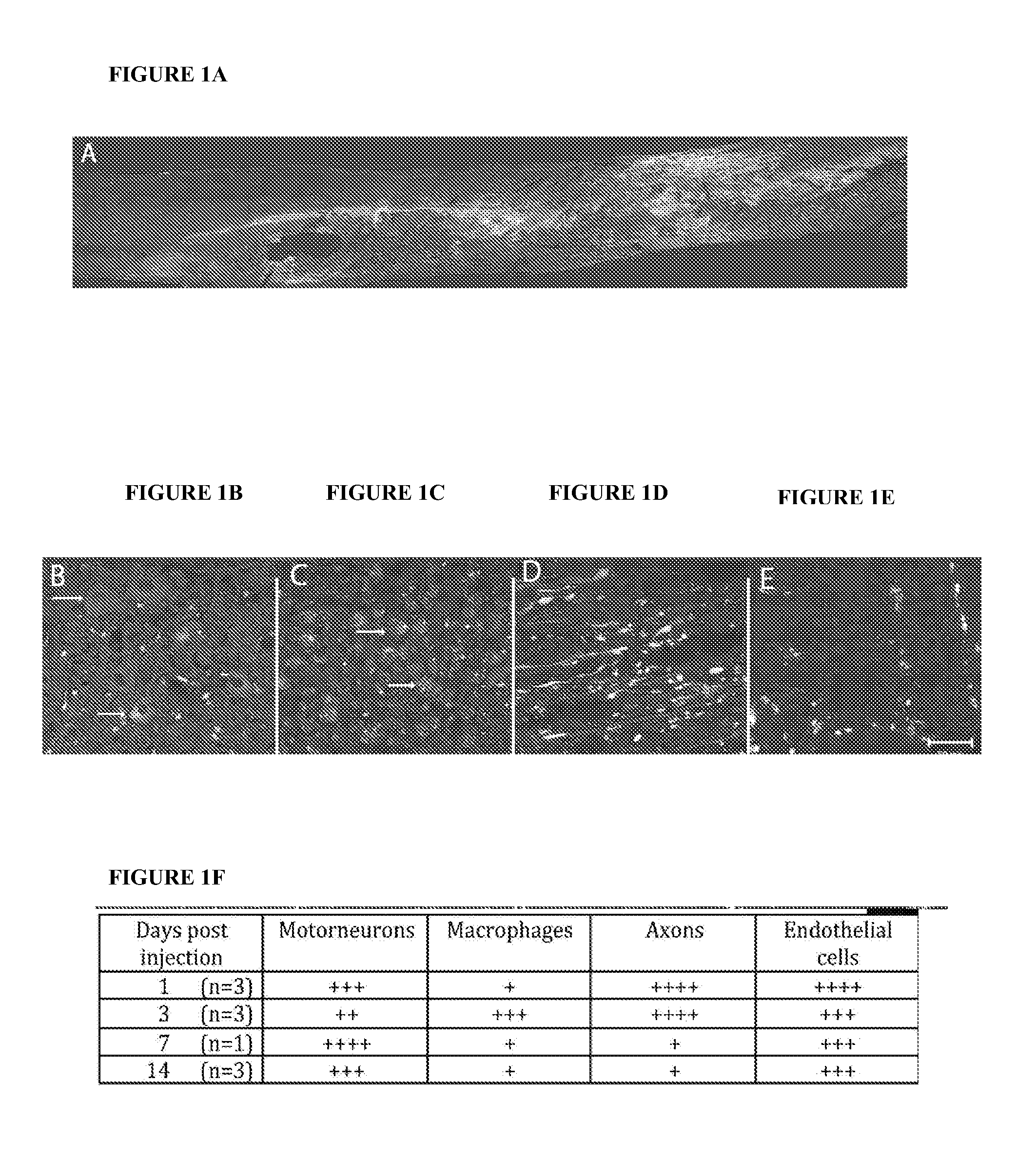 Methods for delivery of siRNA to the spinal cord and therapies arising therefrom