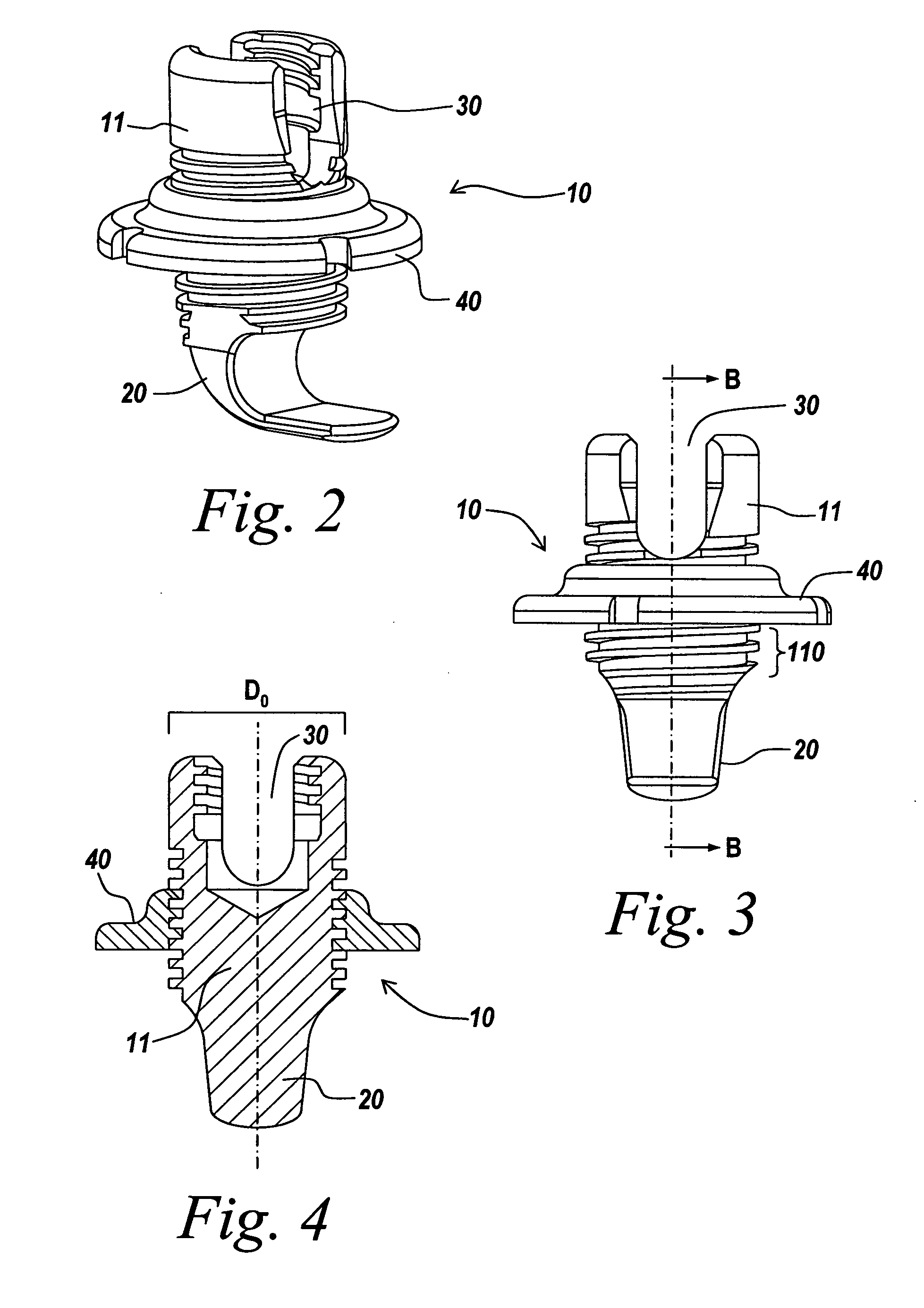 Orthopedic clamping hook assembly