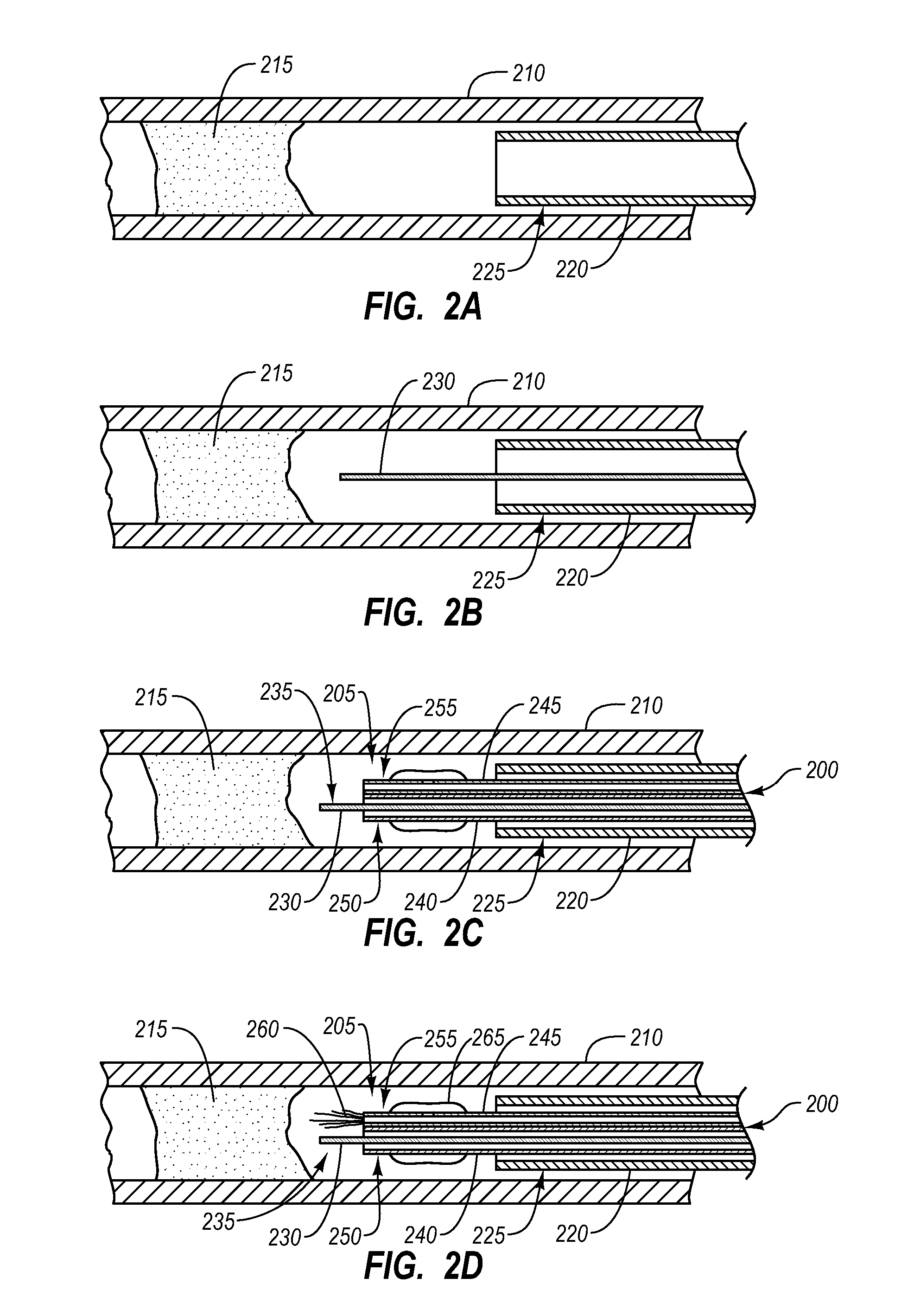 Systems, Methods, and Devices for Injecting Media Contrast