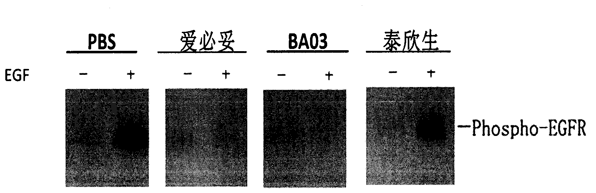 Humanized antibody against epidermal growth factor receptor and application thereof