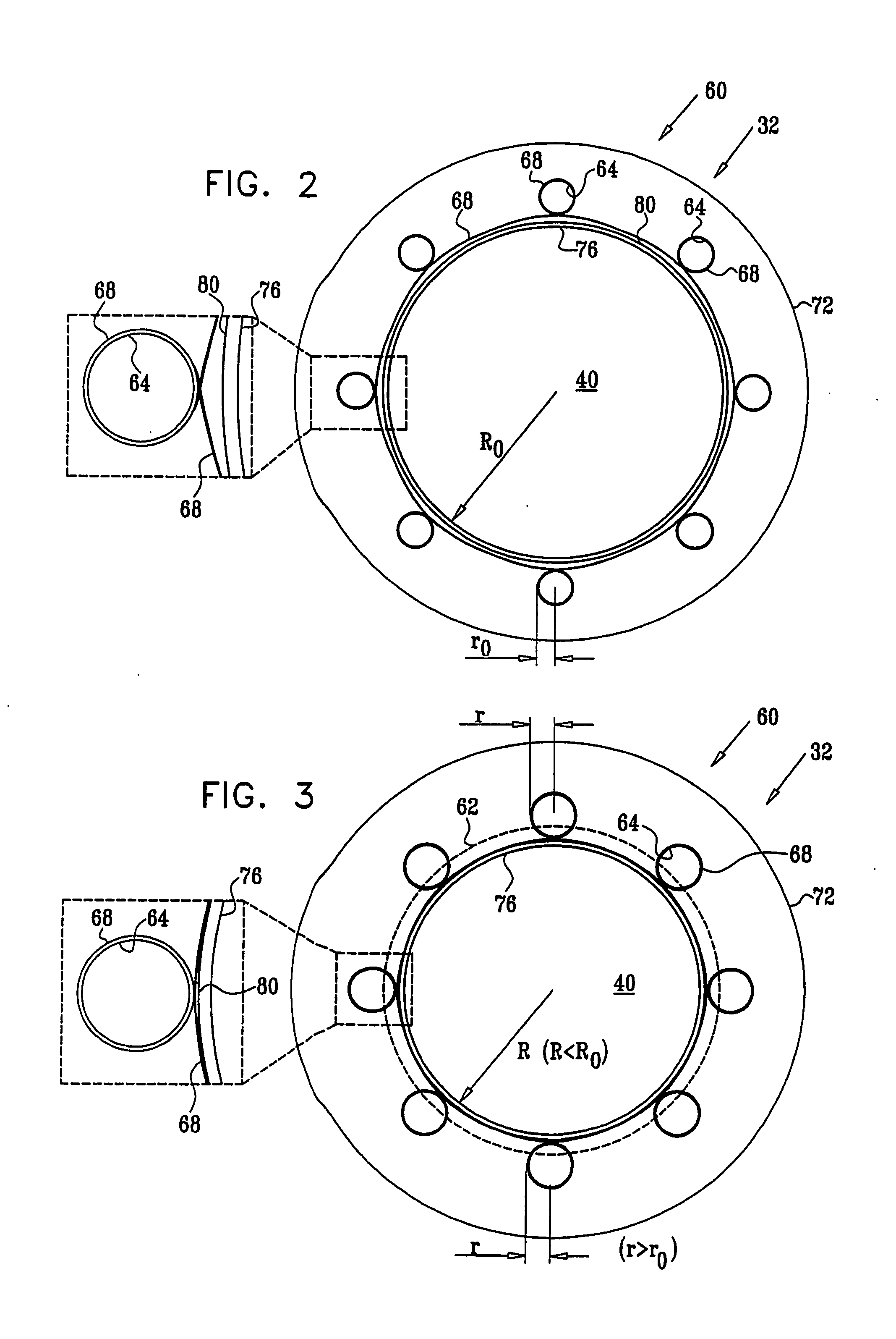 Amplification-Based Cardiac Assist Device