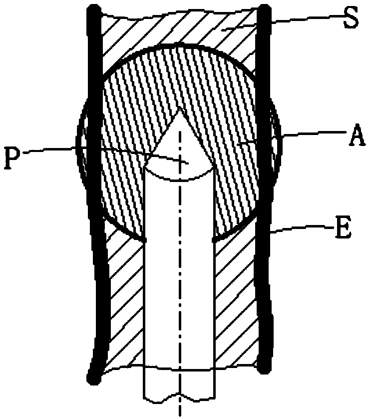 Melting needle assembly and melting system suitable for treating hypertrophic cardiomyopathy