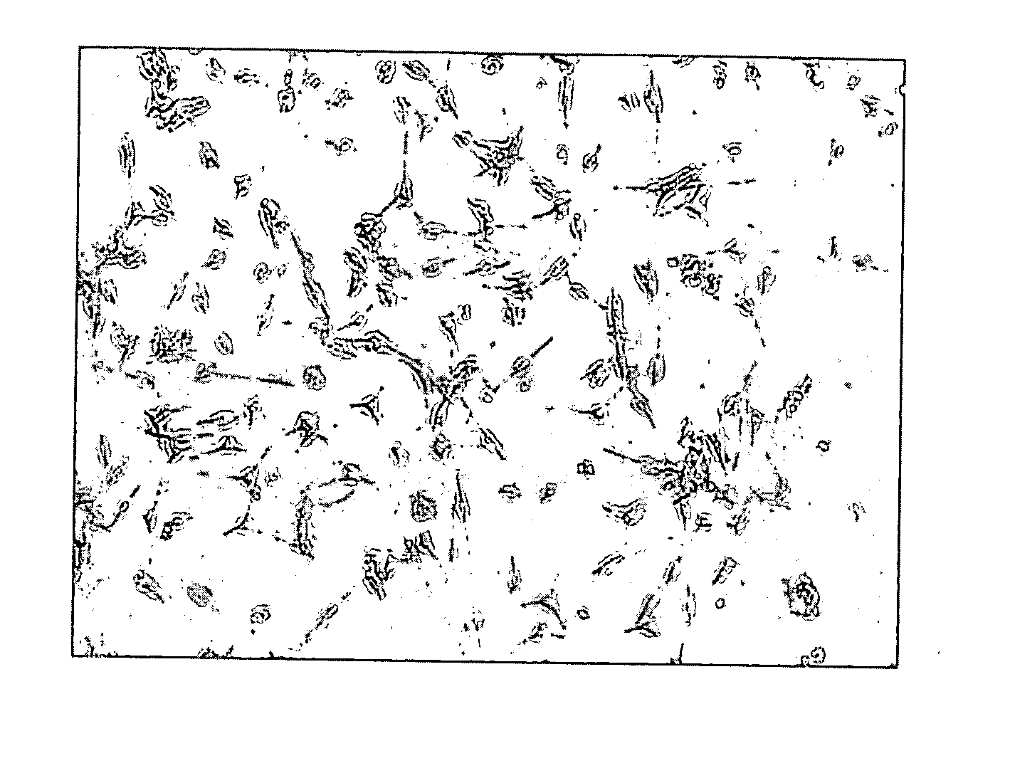 Conditioned medium for culturing Schwann cells