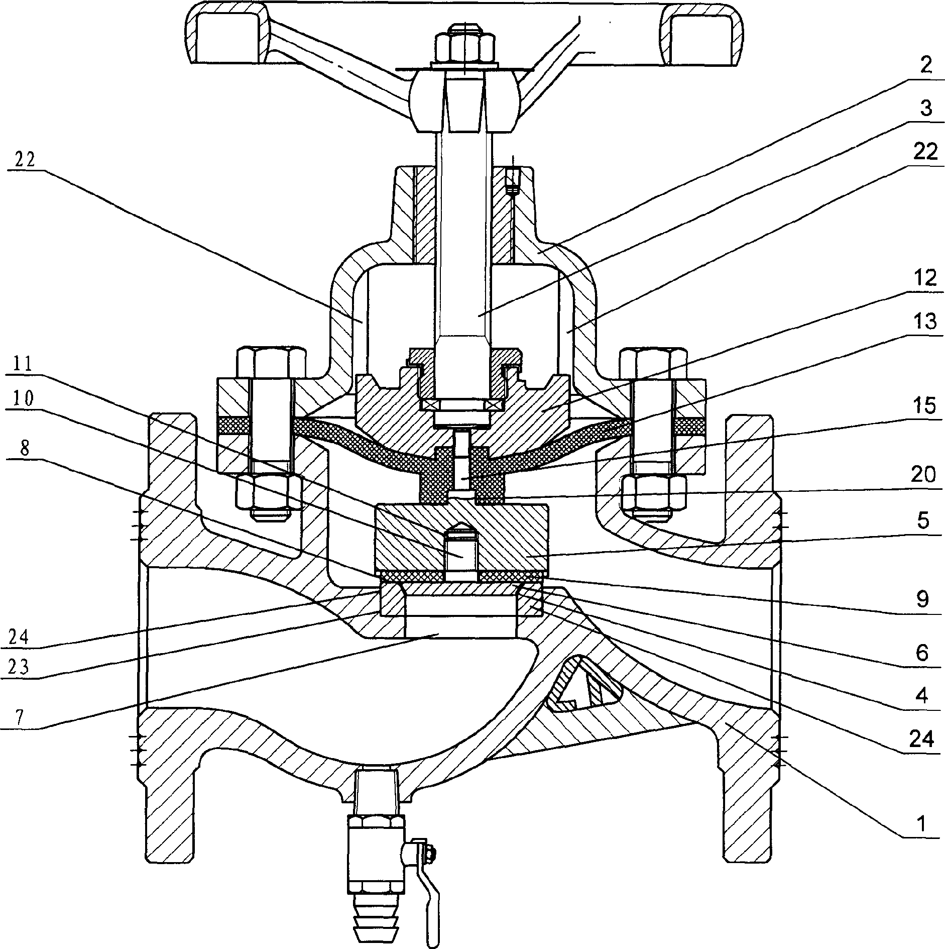 Multifunctional valve