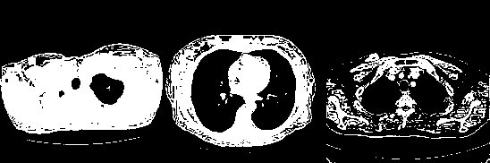 Lung nodule detection model construction method