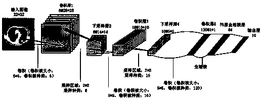 Lung nodule detection model construction method