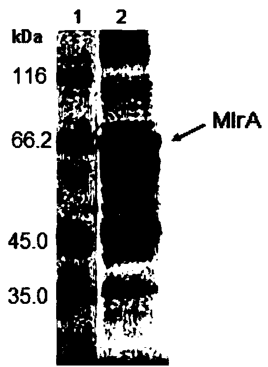 Immobilized algal toxin degrading enzyme as well as preparation method and application thereof