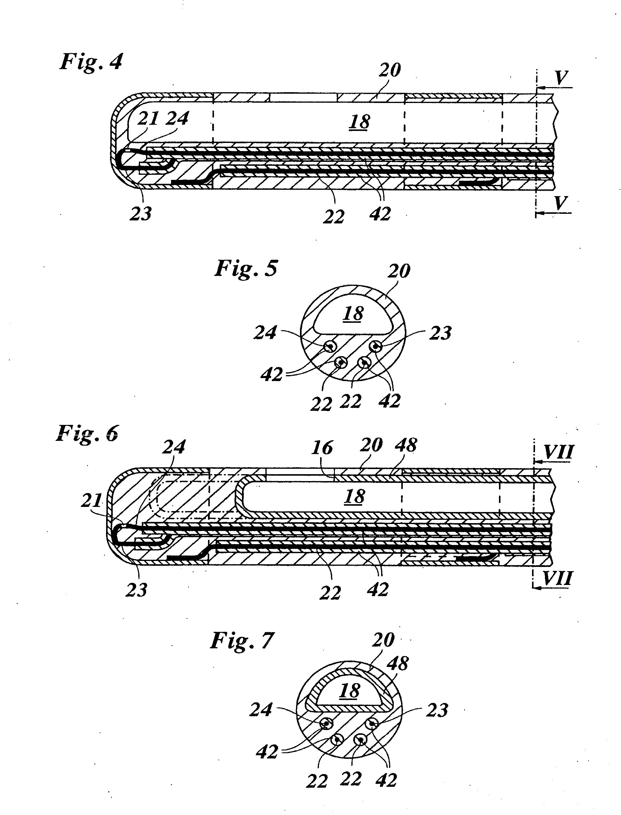 Method for applying pulsed radio frequency energy to the spinal canal