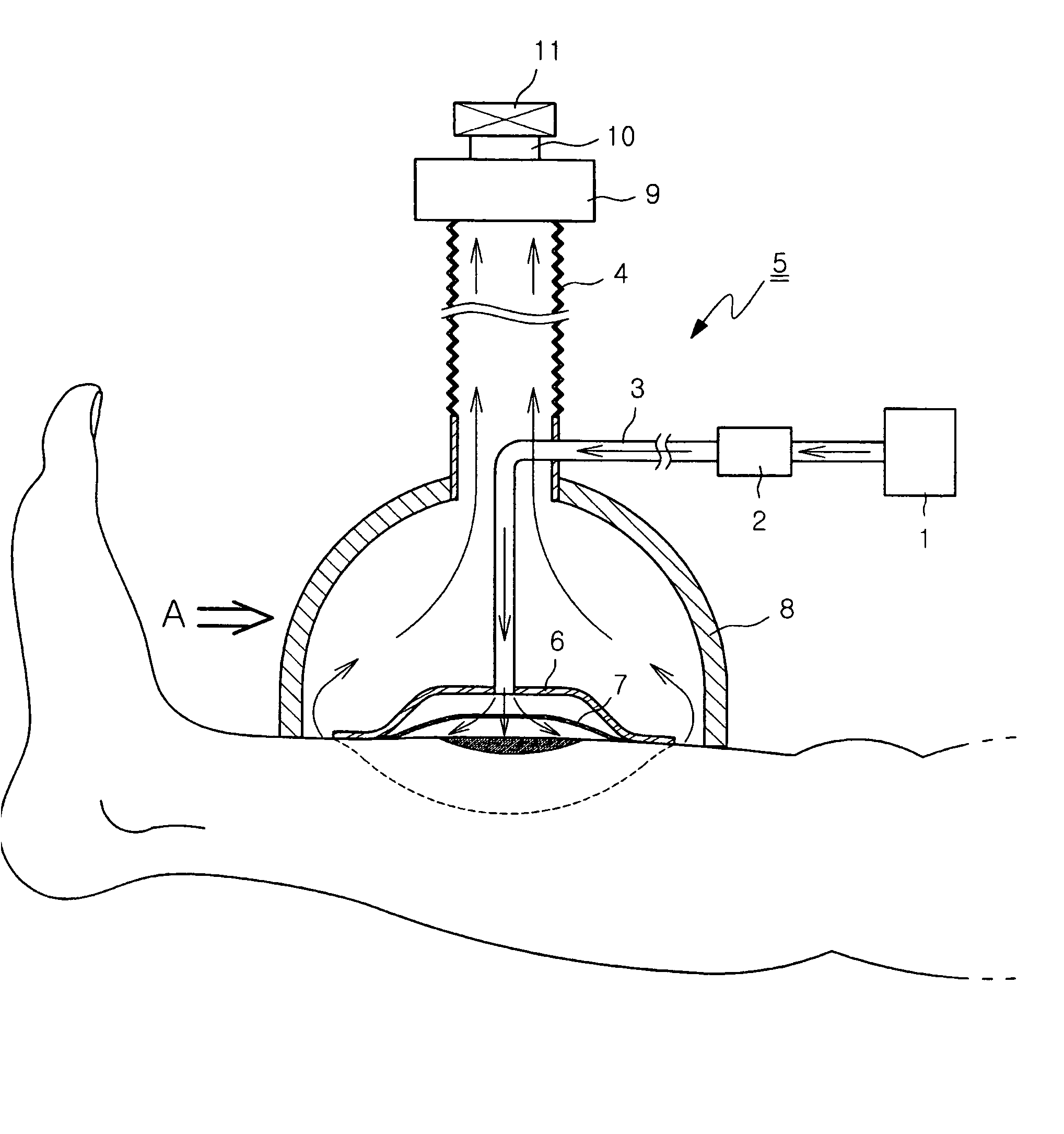 Ozone treatment apparatus using ozone gas