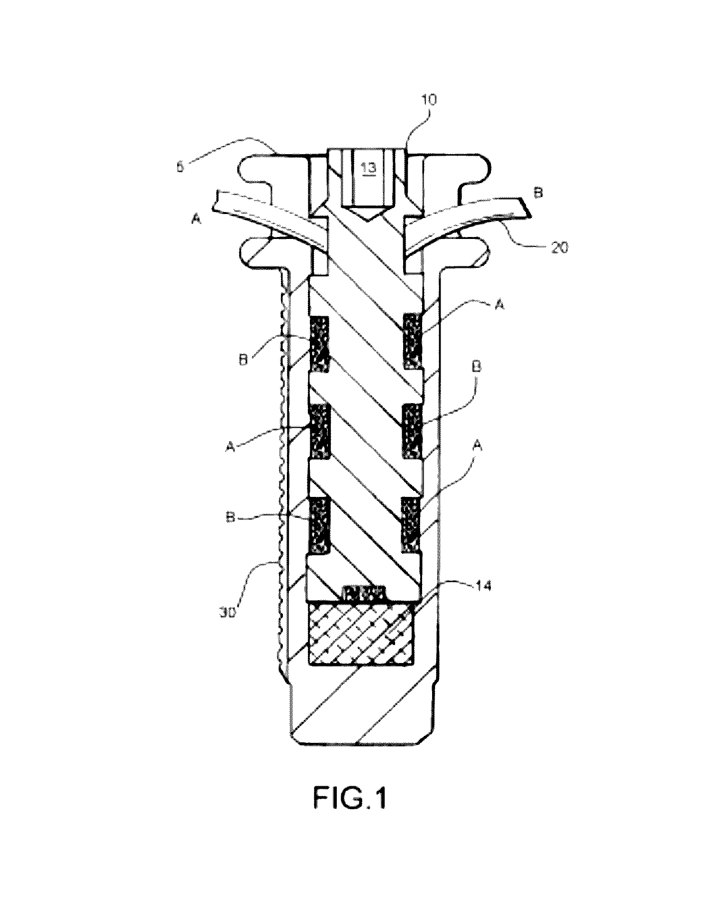 Internal joint bracing system and suture anchoring assembly therefore