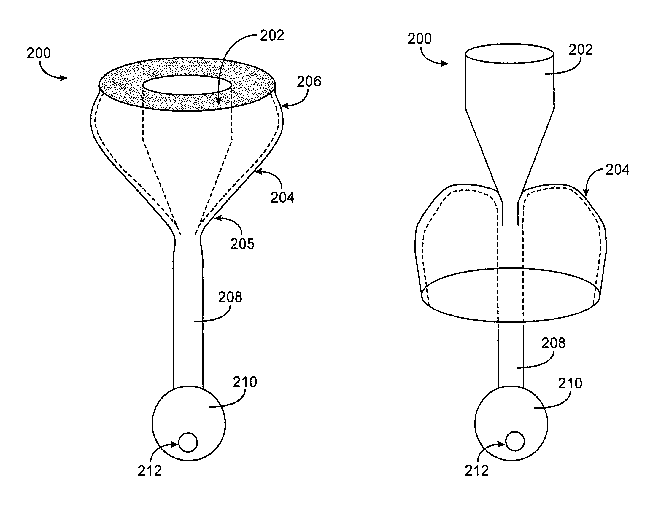 Pyloric valve obstructing devices and methods