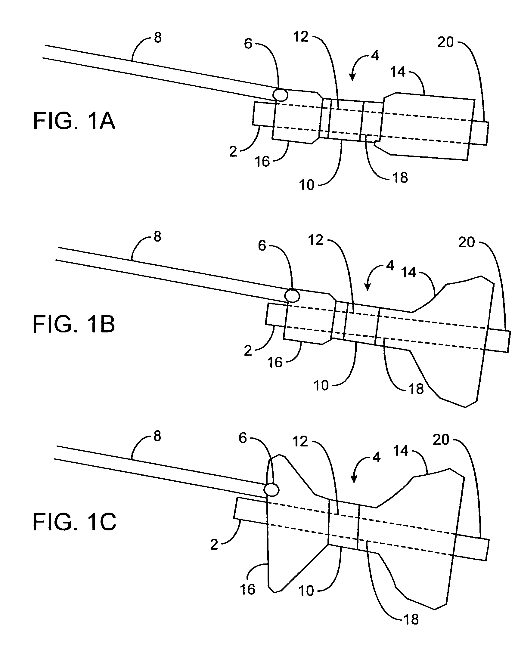 Pyloric valve obstructing devices and methods