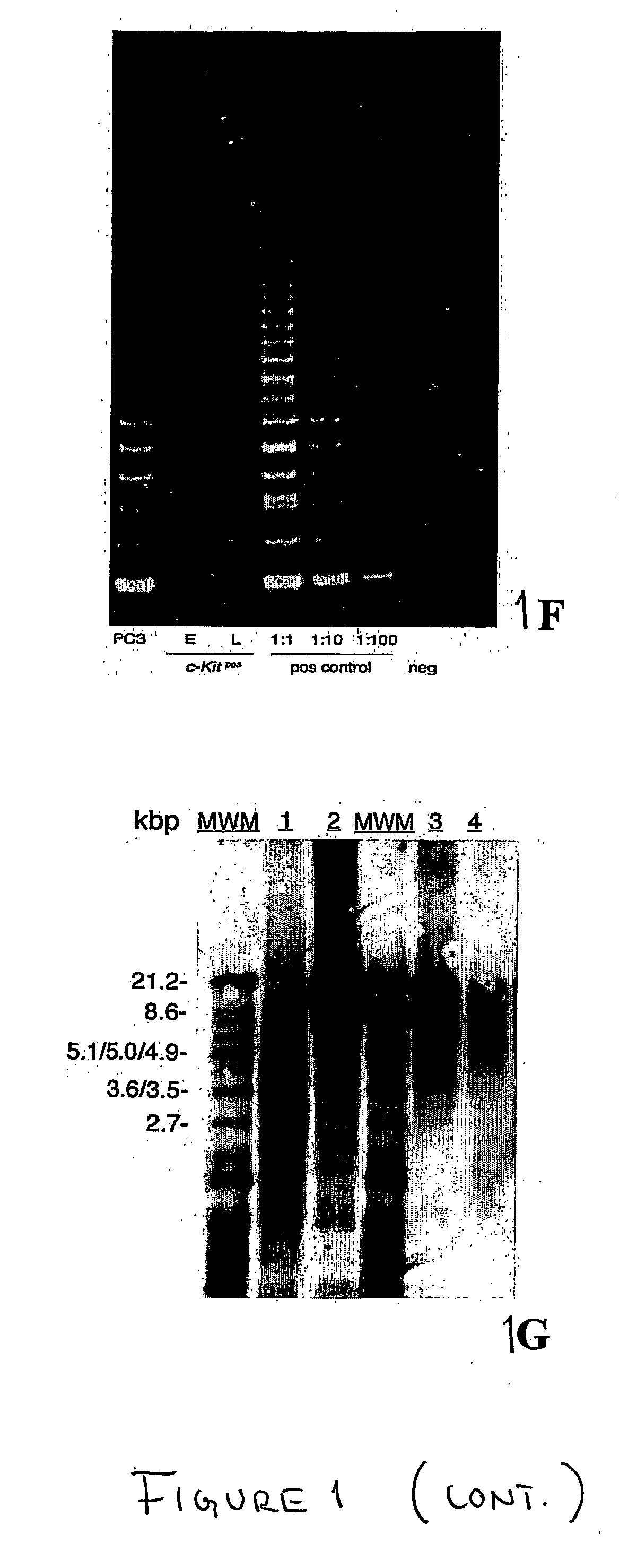 Methods of isolation, expansion and differentiation of fetal stem cells from chorionic villus, amniotic fluid, and placenta and therapeutic uses thereof