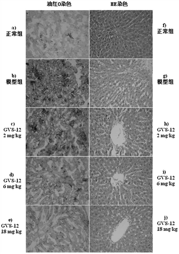 Novel gvs series compound and its application