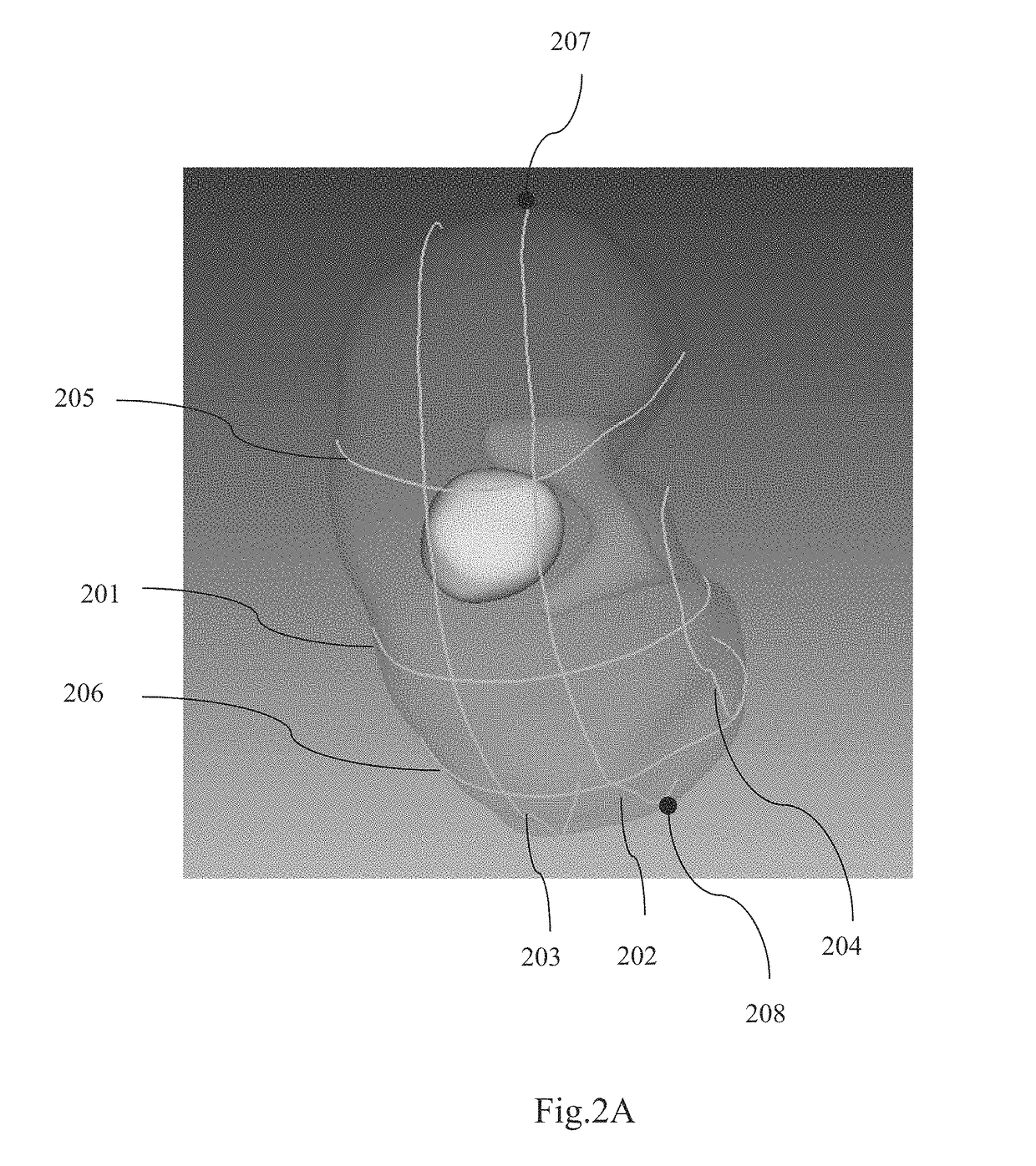 Method and system for interactive grid placement and measurements for lesion removal