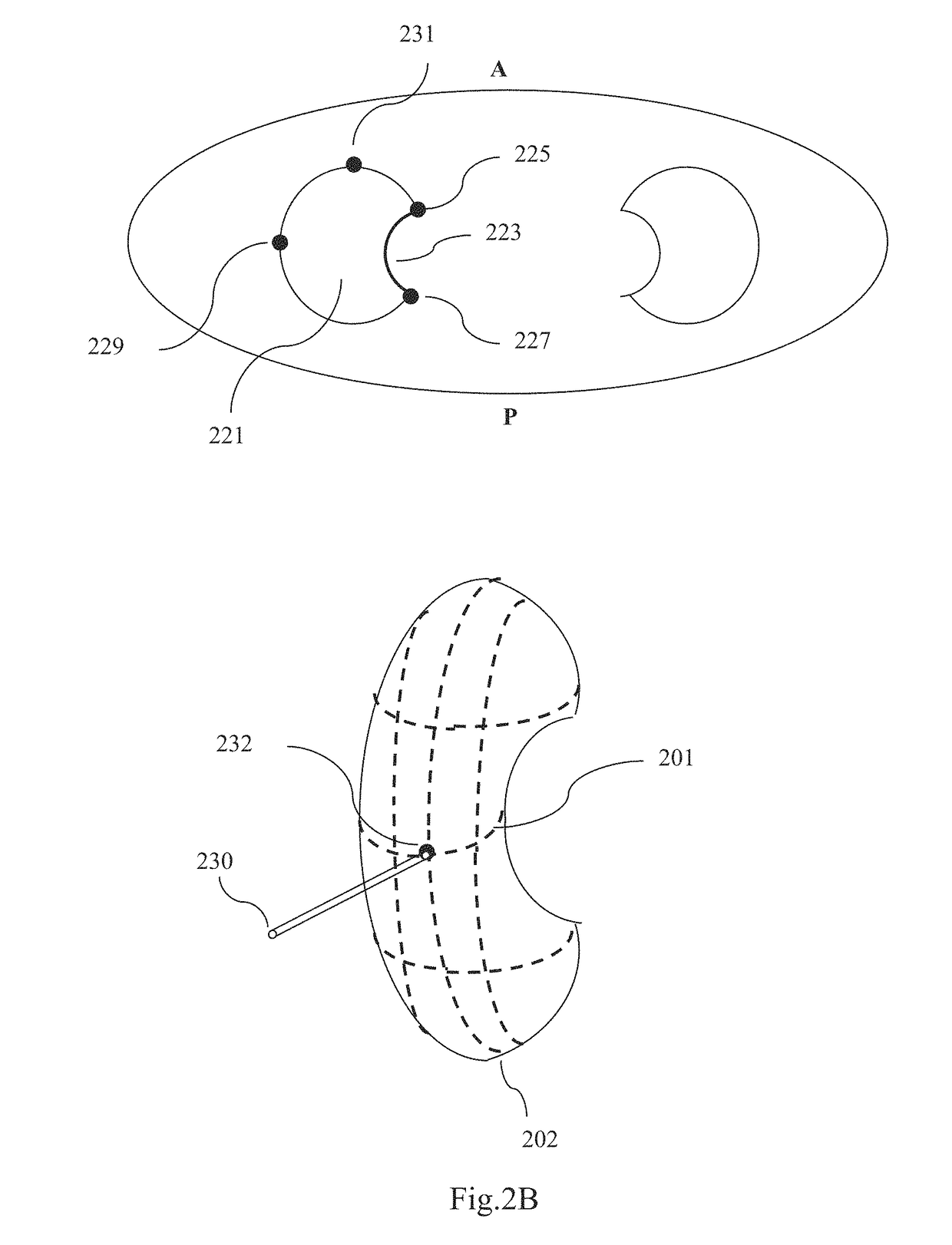 Method and system for interactive grid placement and measurements for lesion removal