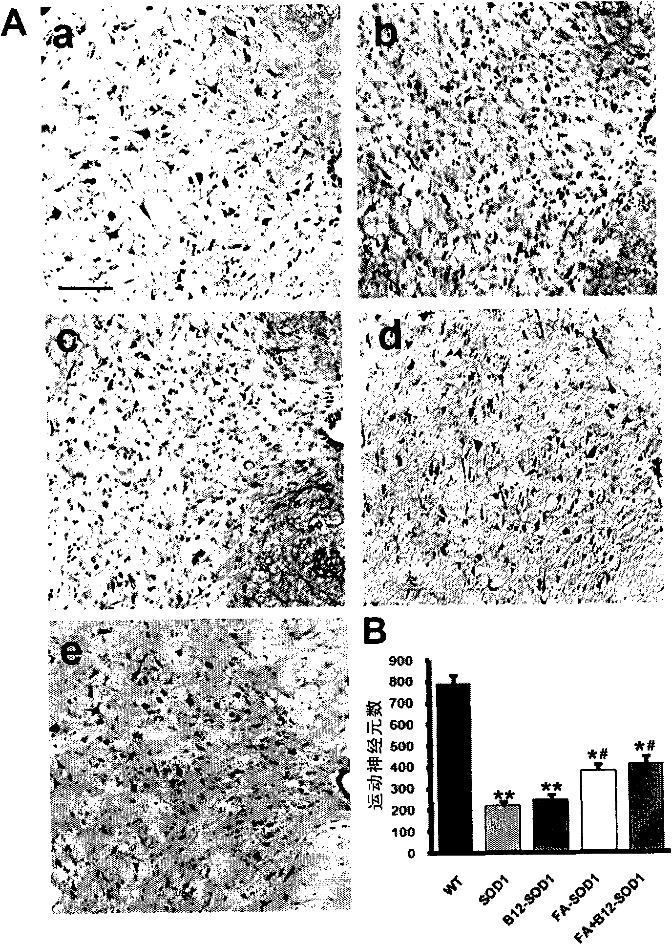 Composition for preventing and treating amyotrophic lateral sclerosis