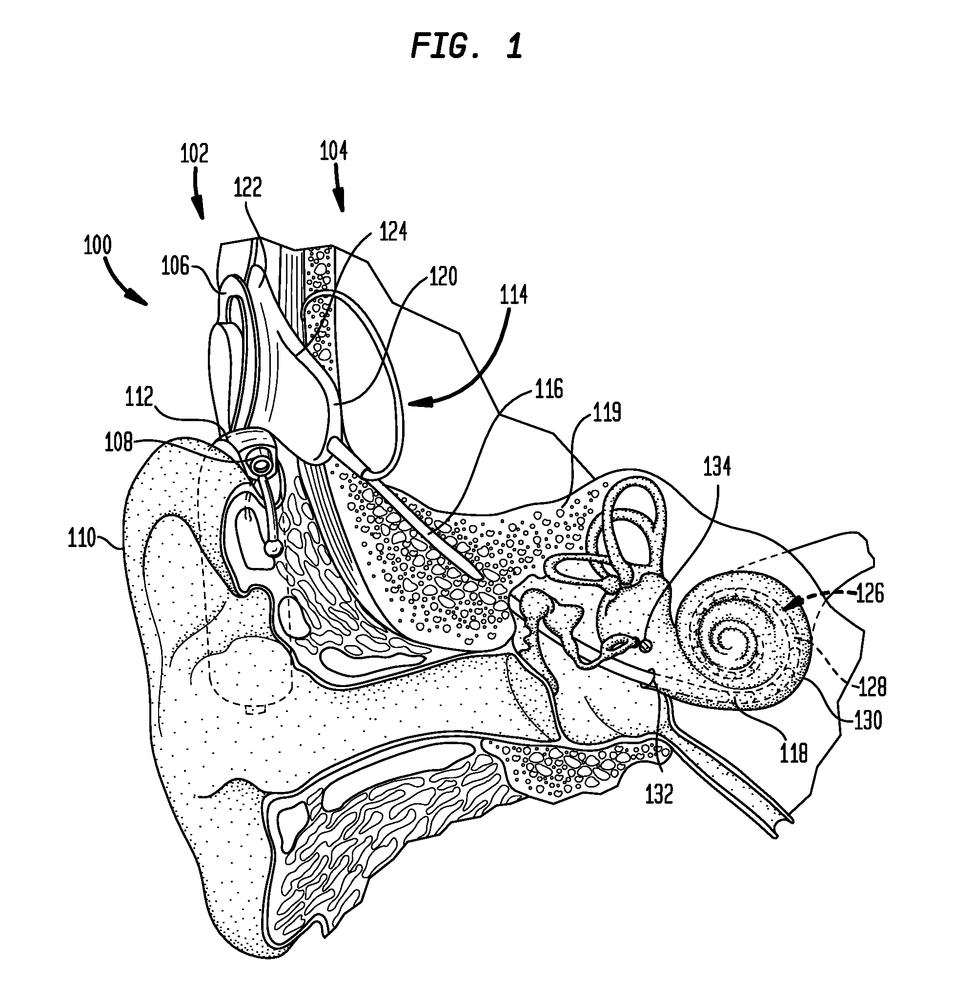 Stimulation parameter optimization