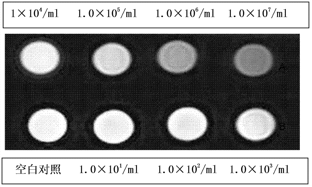 Nasopharyngeal carcinoma targeted magnetic resonance contrast agent and preparation method thereof