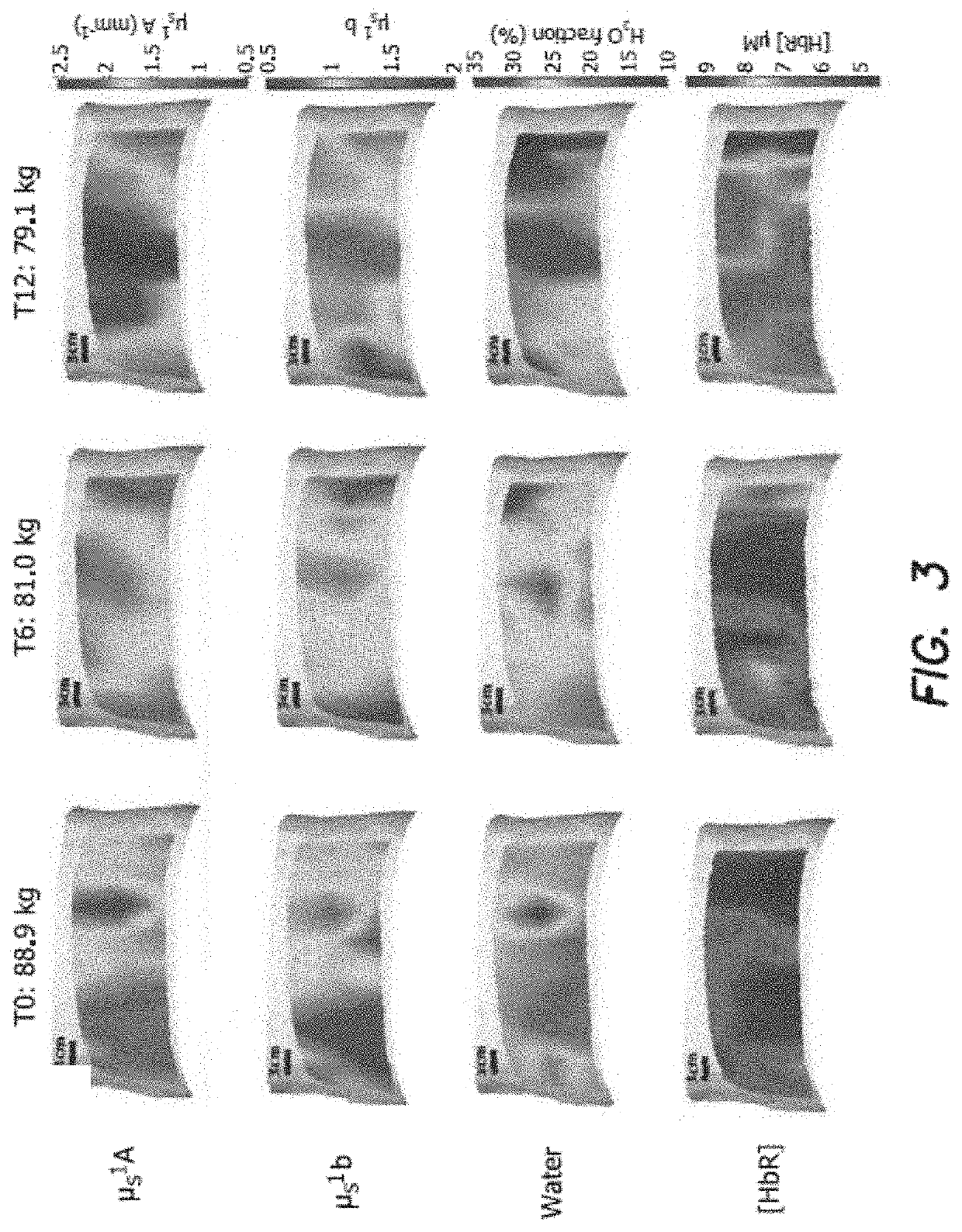 Predicting weight loss and fat metabolism using optical signal changes in fat