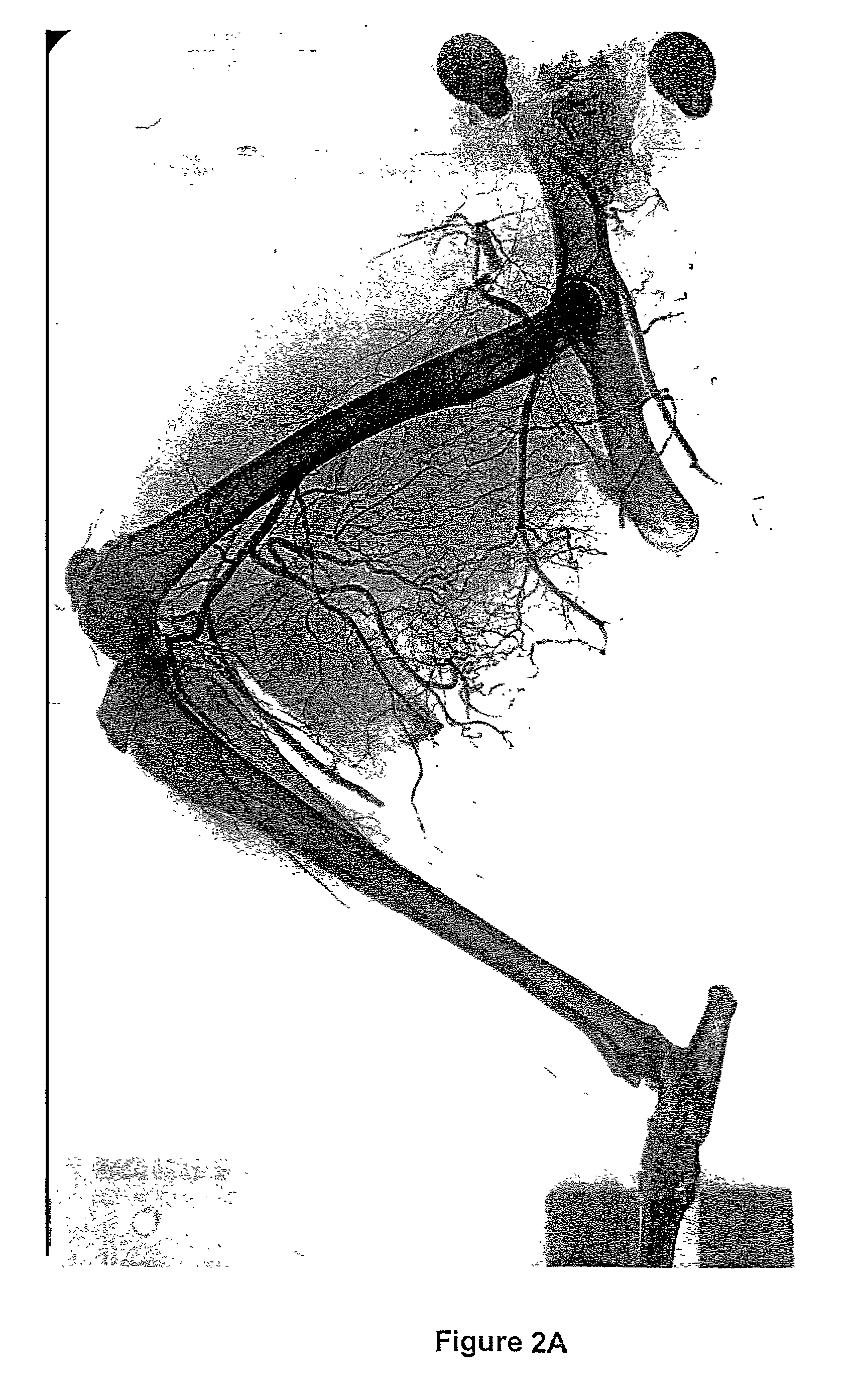 Methods for the modulation of neovascularization and/or the growth of collateral arteries and/or other arteries from preexisting arteriolar connections