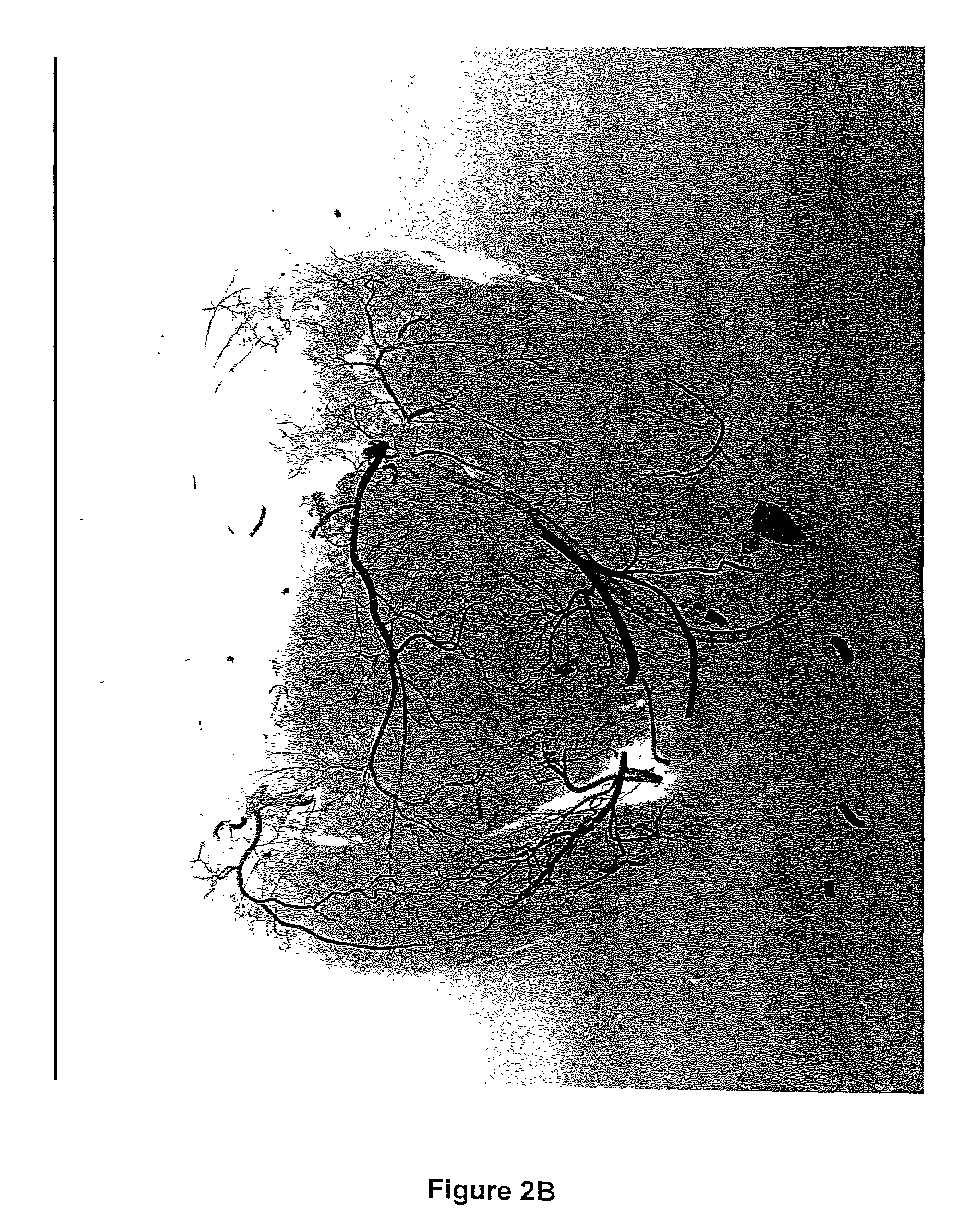 Methods for the modulation of neovascularization and/or the growth of collateral arteries and/or other arteries from preexisting arteriolar connections