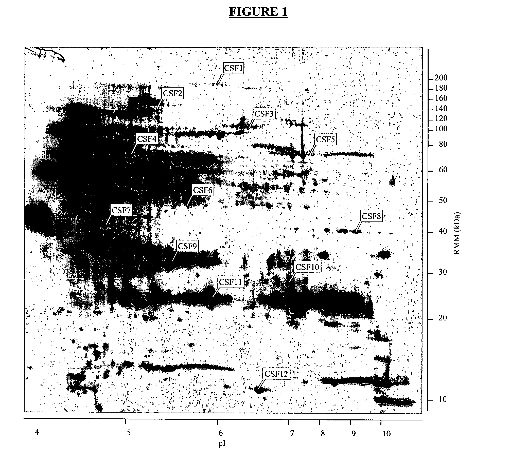 Nucleic acid molecules, polypeptides and uses therefor, including diagnosis and treatment of Alzheimer's disease