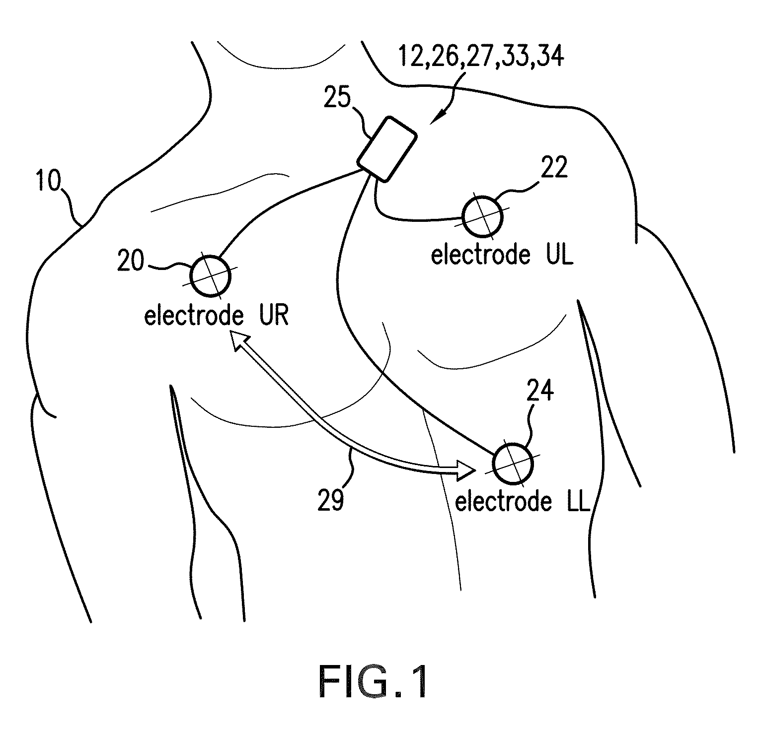 Body-worn monitor for measuring respiratory rate