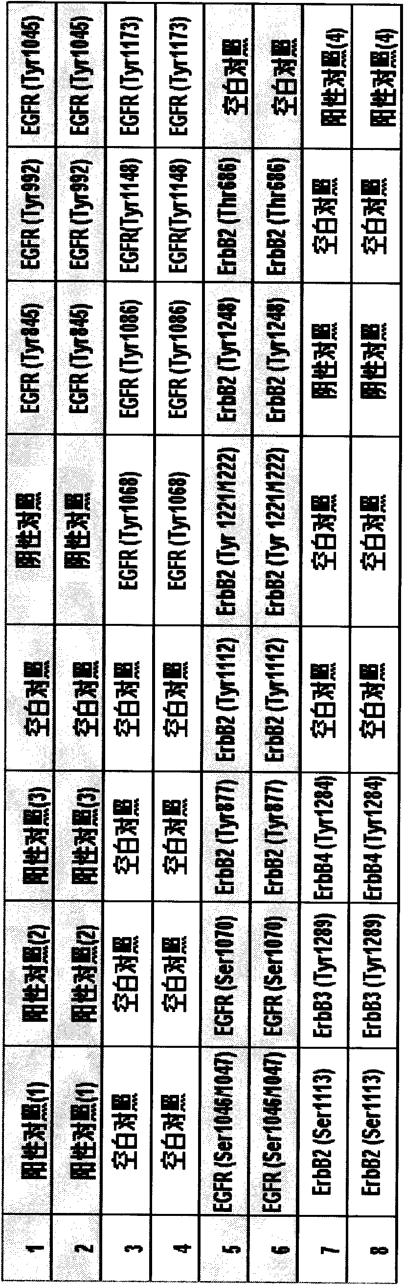 Kit for detecting phosphorylated epidermal growth factor receptor and preparation method thereof