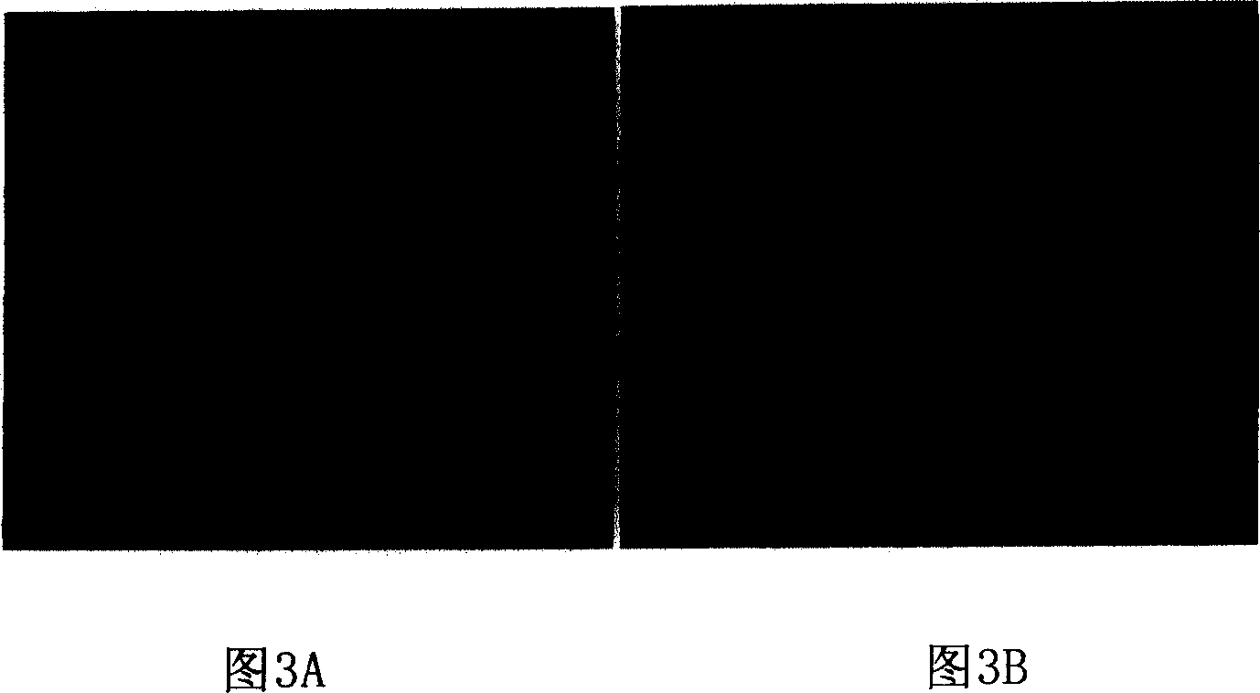 The coupling substrate between magnetic resonance imaging contrast agent based on metal fullerene and antibody and the detecting technology