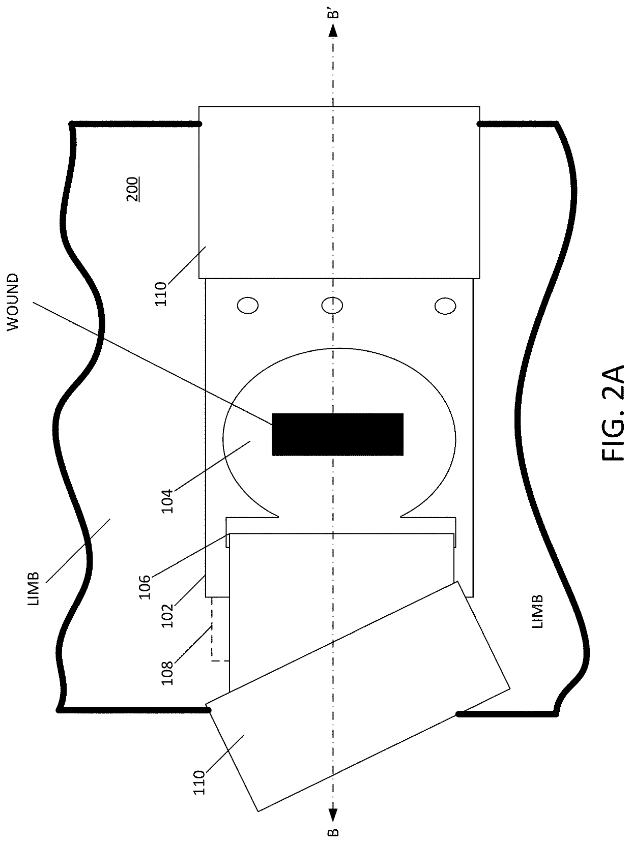 Enhanced trauma bandage