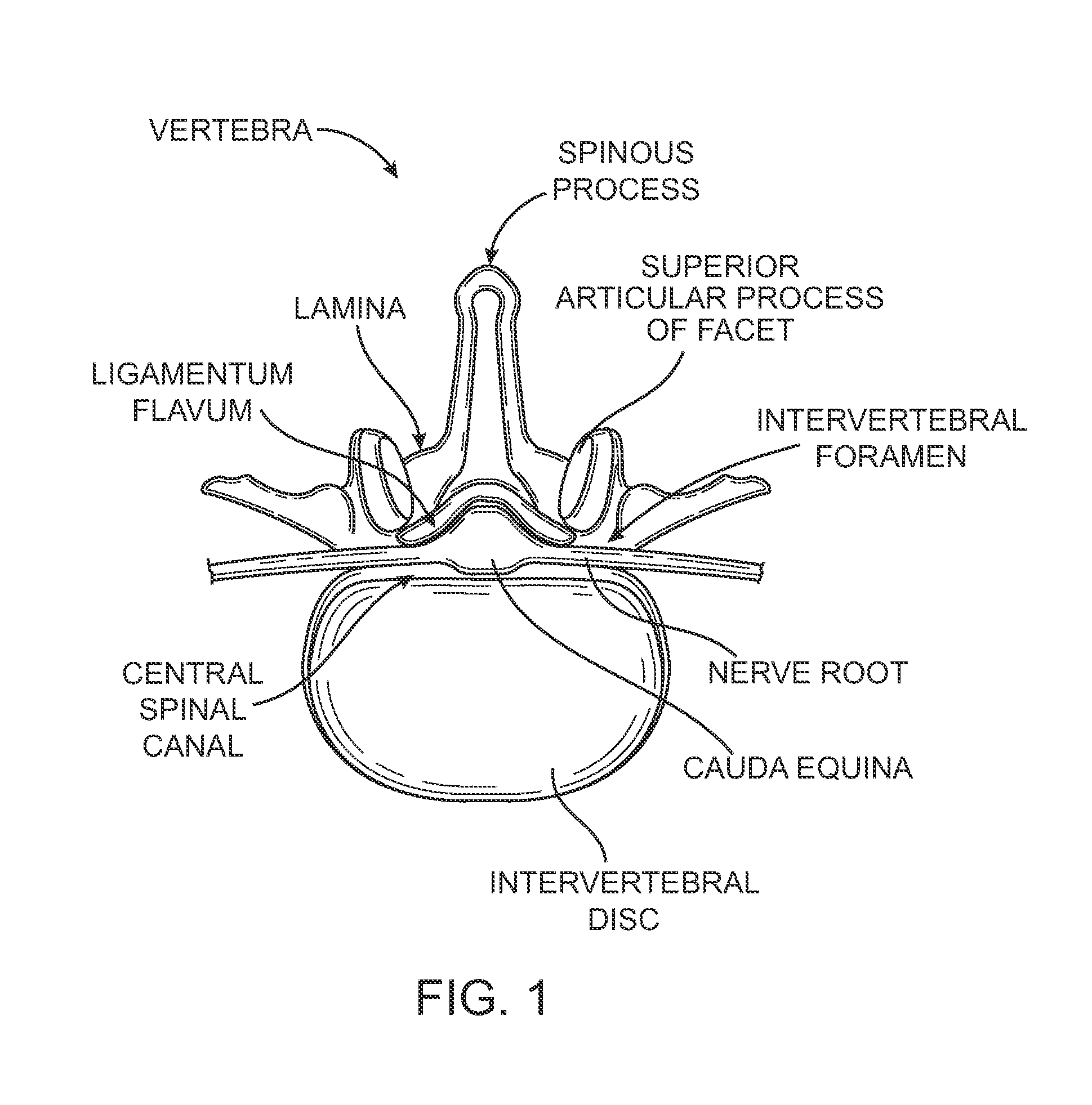 Methods, systems and devices for carpal tunnel release