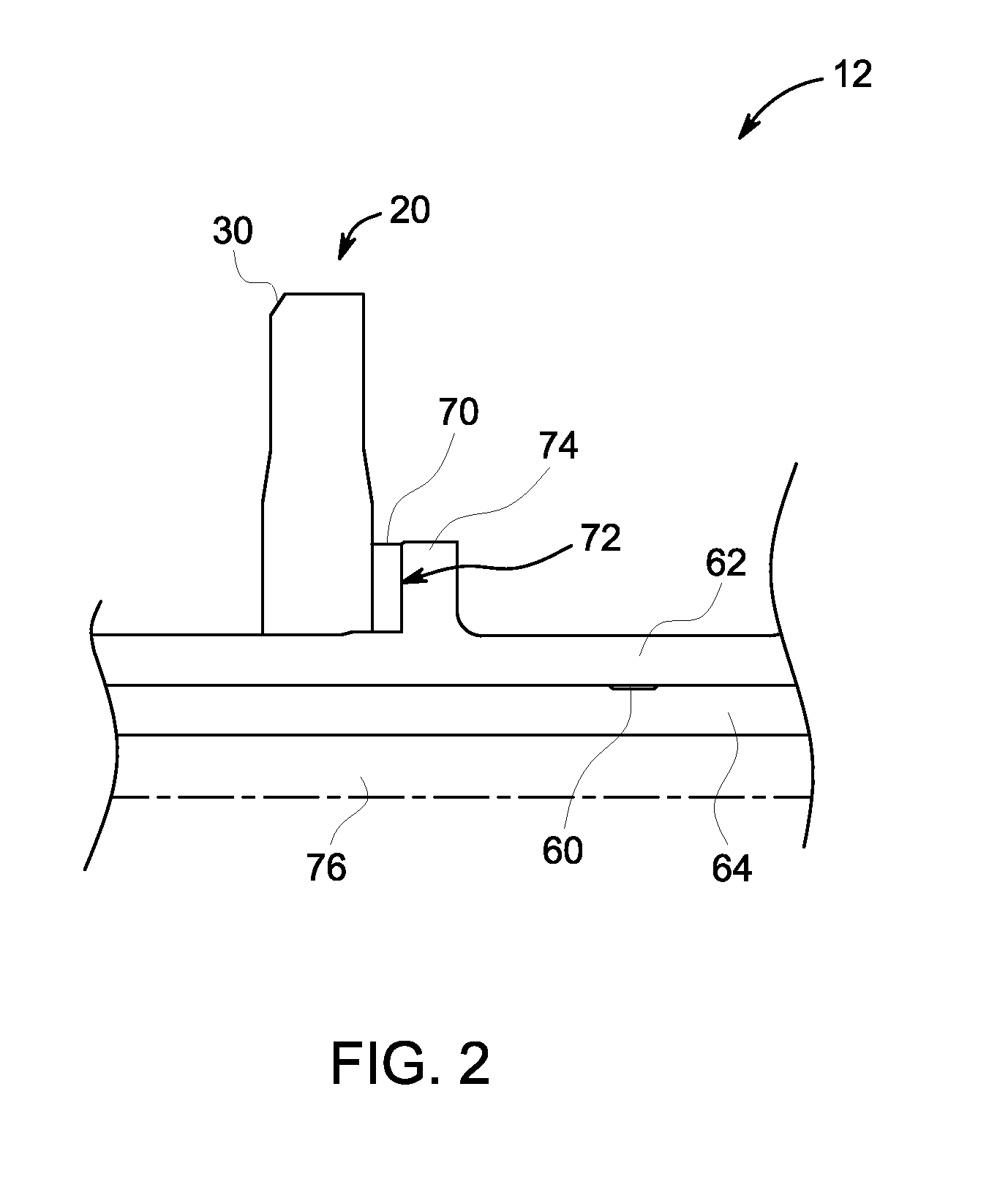 X-ray tube with bonded target and bearing sleeve