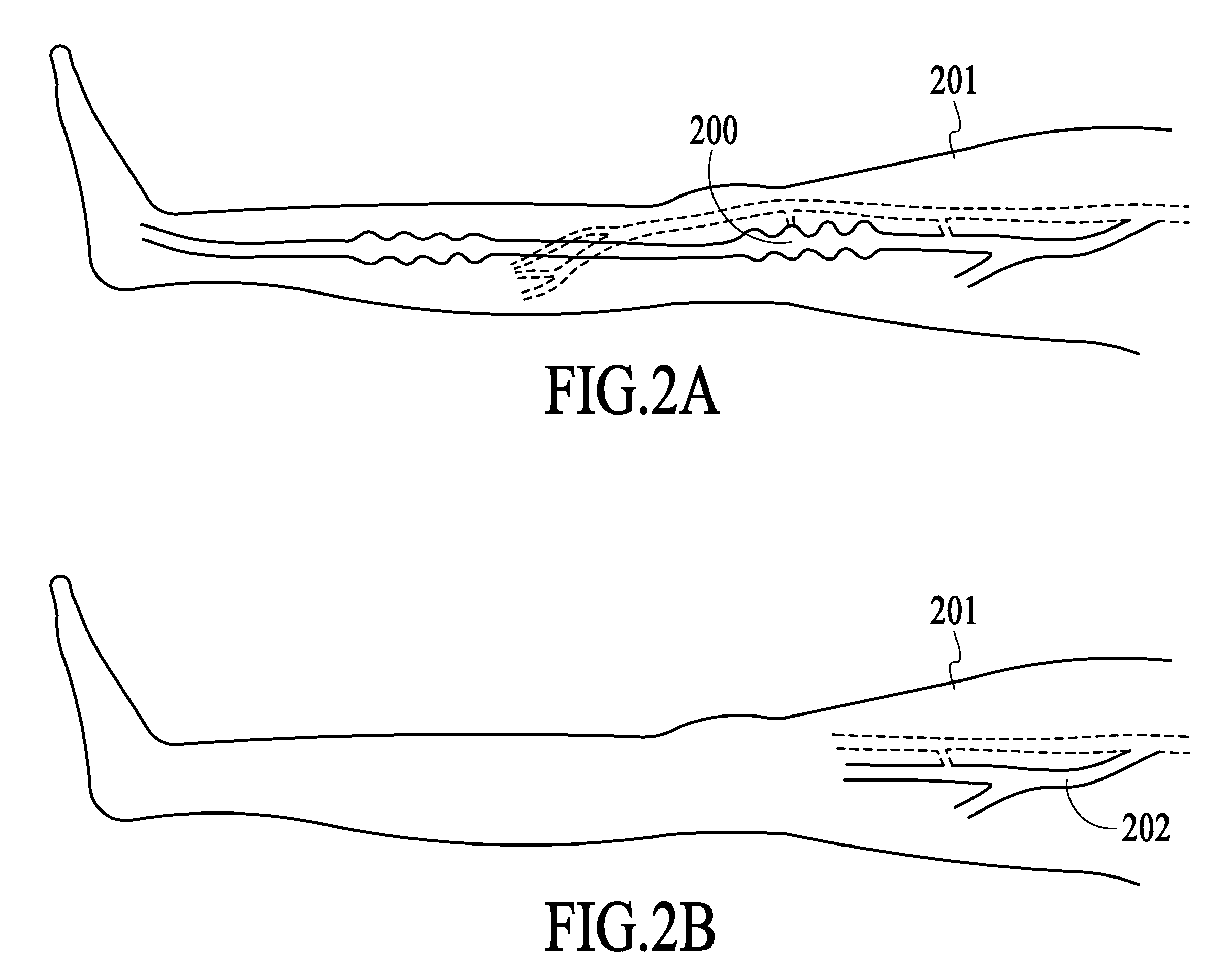 Endovenous laser treatment generating reduced blood coagulation