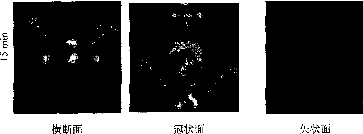 [*F] fluoraro-marked purine compound, its production and use