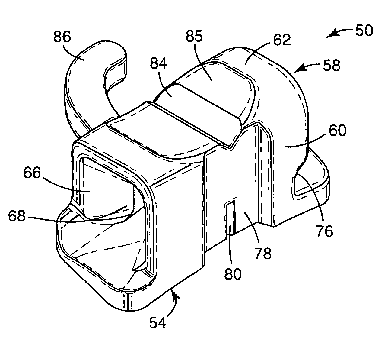 Molar appliance for an orthodontic brace