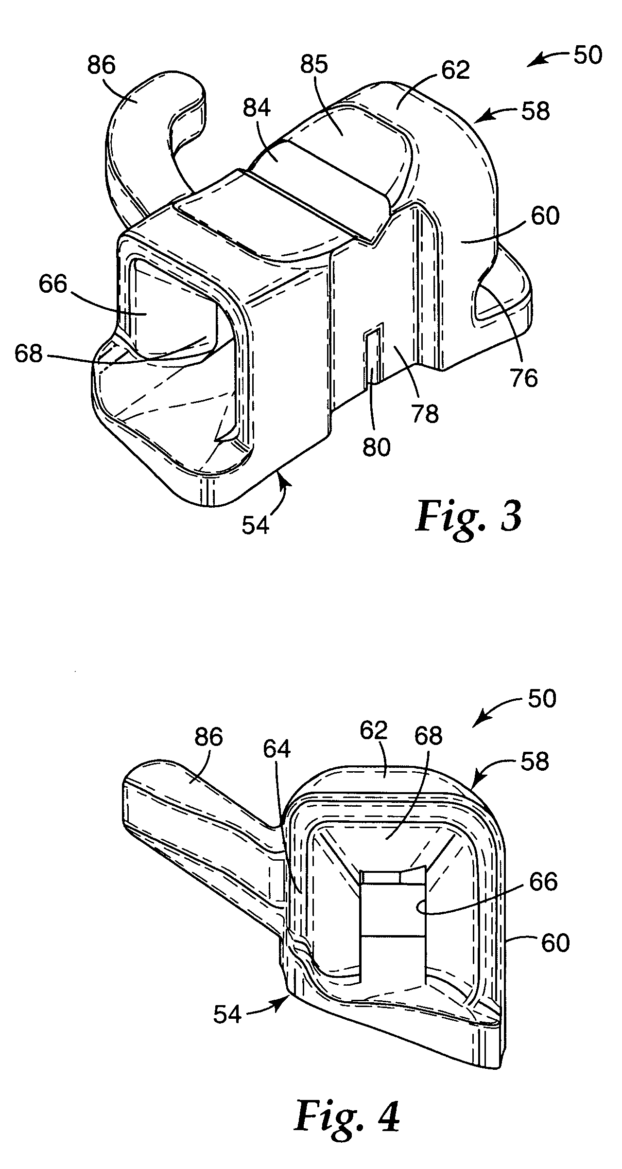 Molar appliance for an orthodontic brace