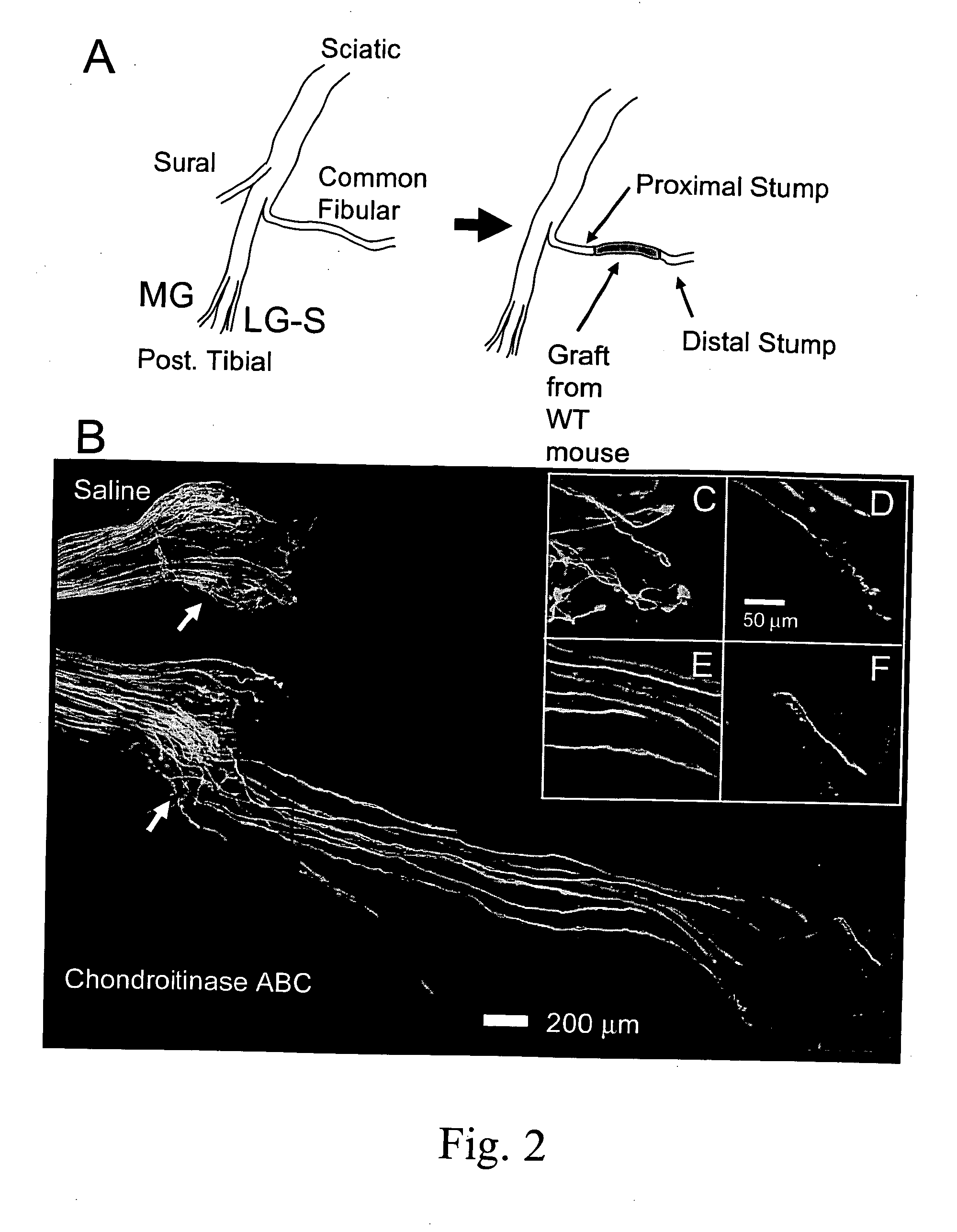 Materials and method for promotion of nerve regeneration