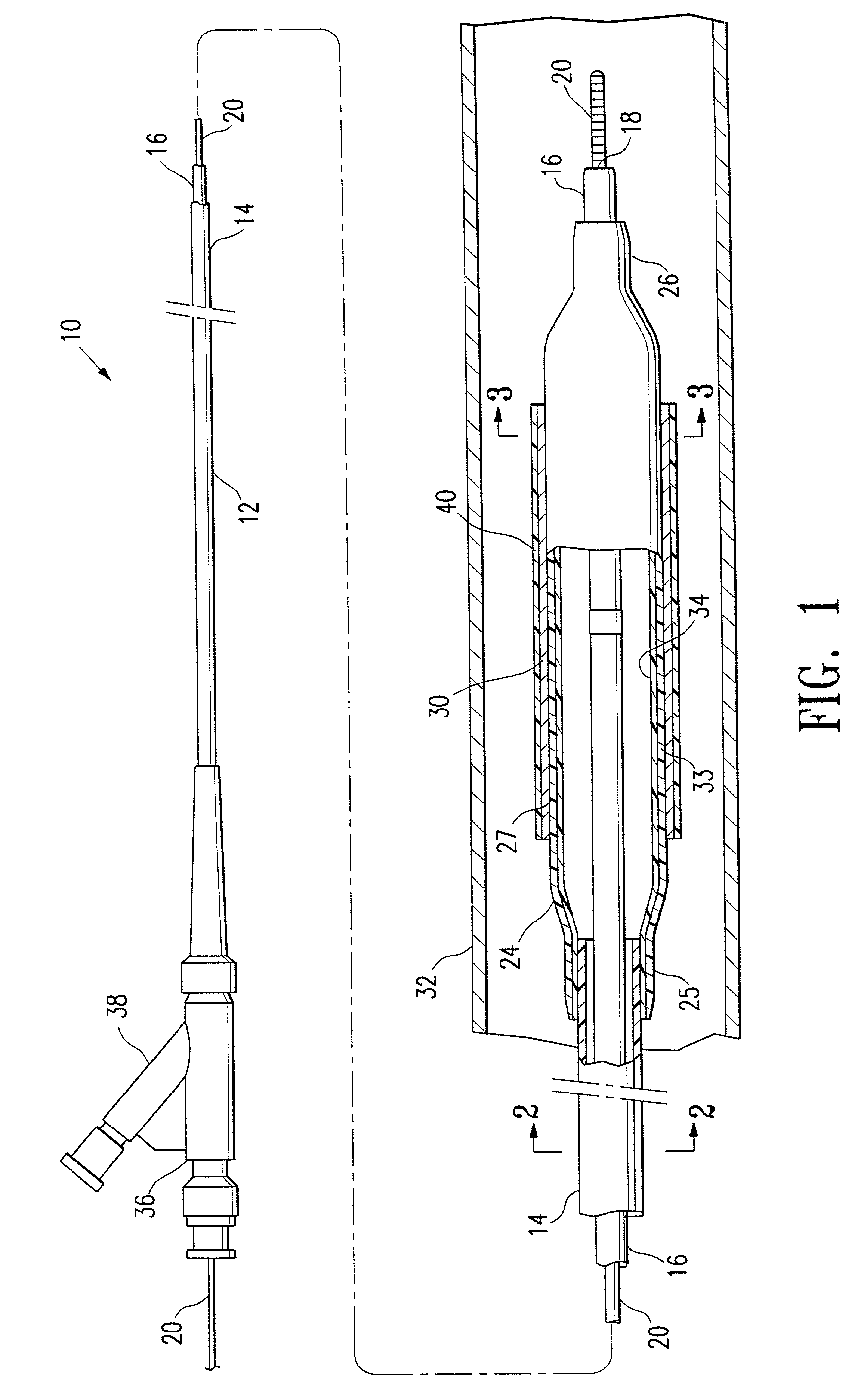 Medical device chemically modified by plasma polymerization