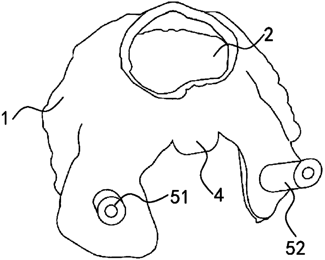 Trigeminal ganglion injection guide plate as well as preparation method and application thereof