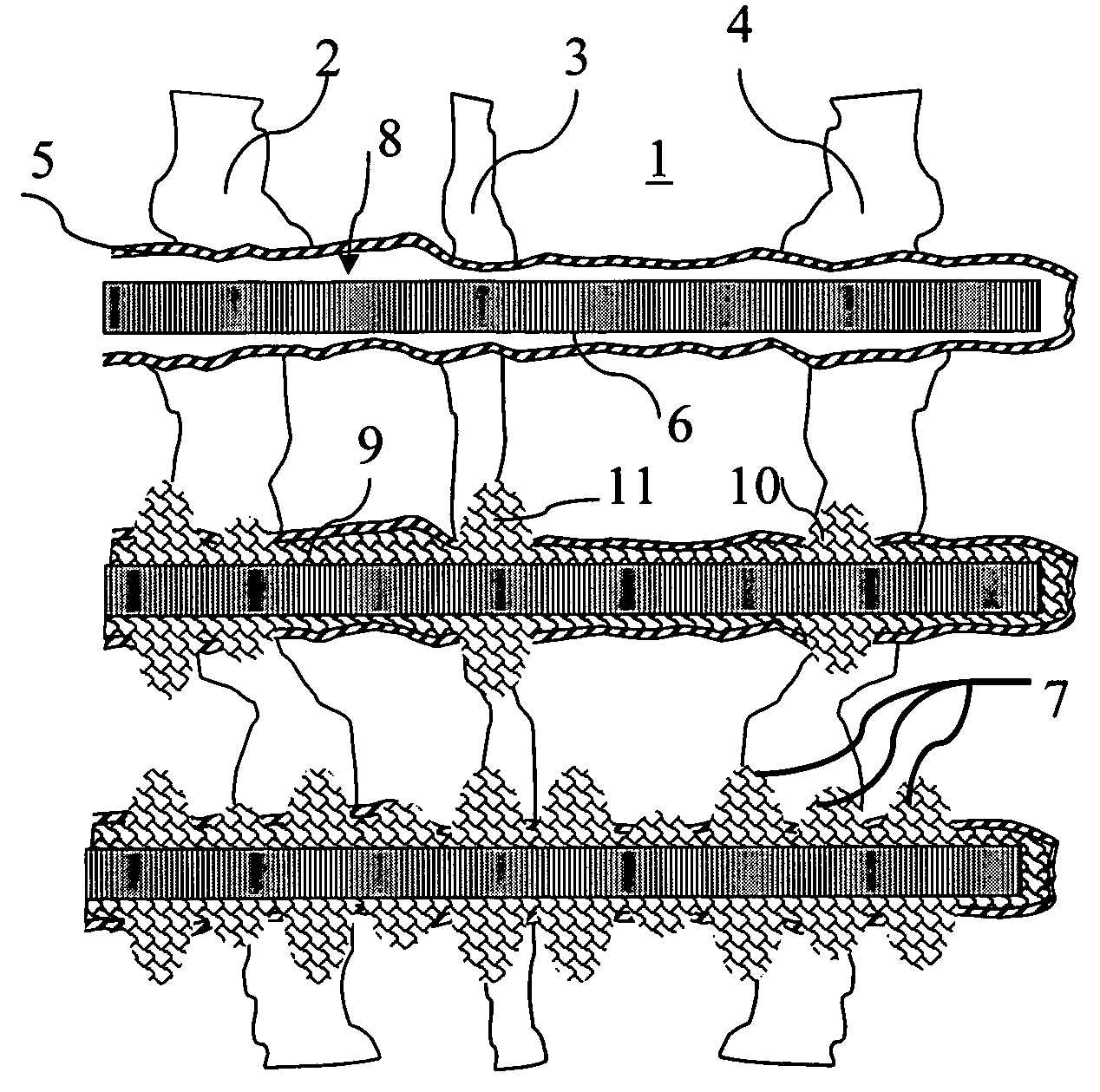 Method and gravel packing open holes above fracturing pressure